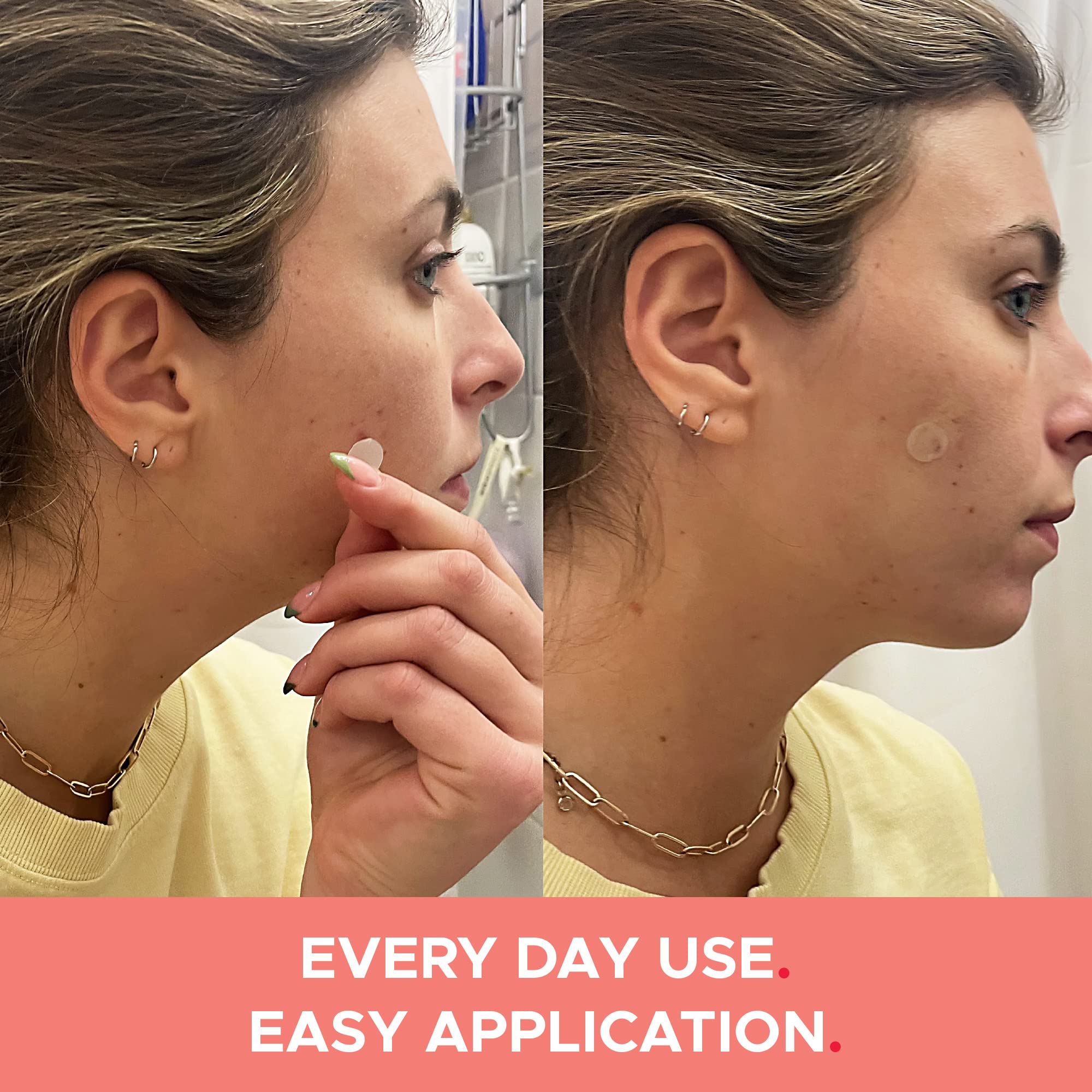 **Fast-Acting Hydrocolloid Acne Patches - SOS SAVER OF SKIN™ Blemish Patches for Pimples, Zits & Breakouts | Absorbs Fluids, Latex-Free, Vegan (40 Count, Transparent) | Perfect for Overnight Acne Treatment & Daily Skin Care**