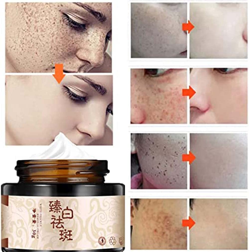 Plant-Based Melanin Freckle Lightening Cream - Dark Spot Corrector & Skin Whitening Treatment for Face (2pc) | Brightens Complexion, Reduces Freckles & Hyperpigmentation | Perfect for Daily Skincare Routine & Evening Skin Tone