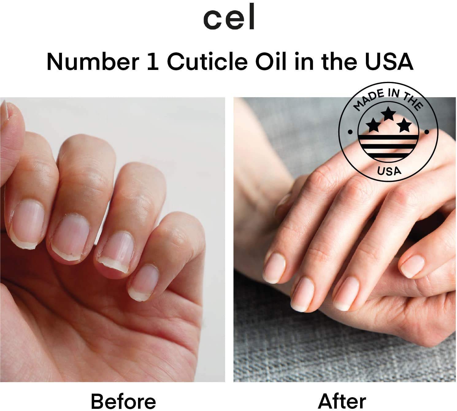 Professional MD Cuticle Oil Pen & Nail Strengthener Repair Serum - Moisturizing Treatment for Damaged, Cracked Nails & Dry Cuticles - 2 Pack Set - Perfect for Salon, Home Manicures & Nail Care Routine