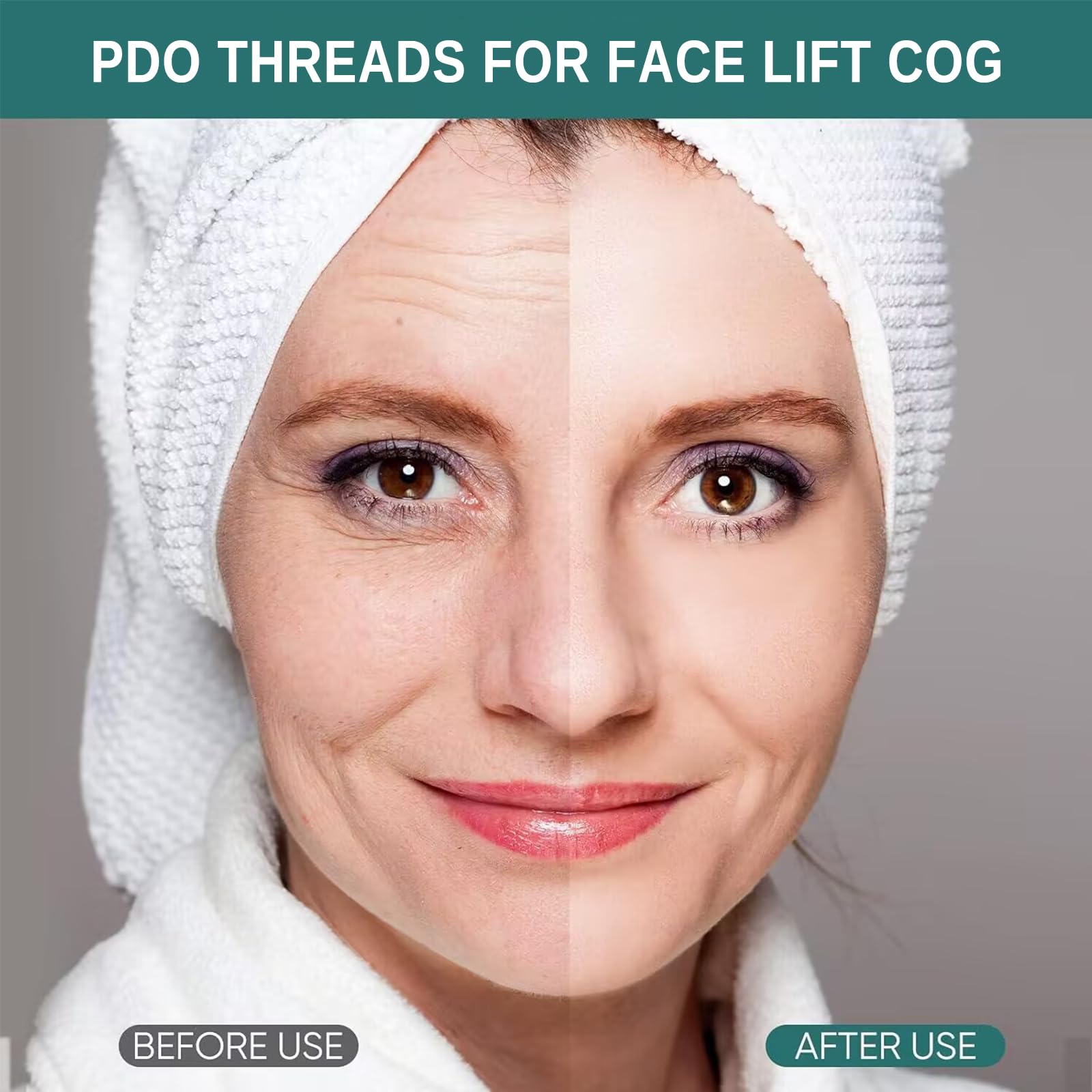 Oldream PDO Threads for Face Lift - 18G 100mm Cog Threads, Anti-Aging Facial Lifting Threads, 20Pcs Blunt Tip Threads | Professional Face Tightening & Wrinkle Reduction for Home Use