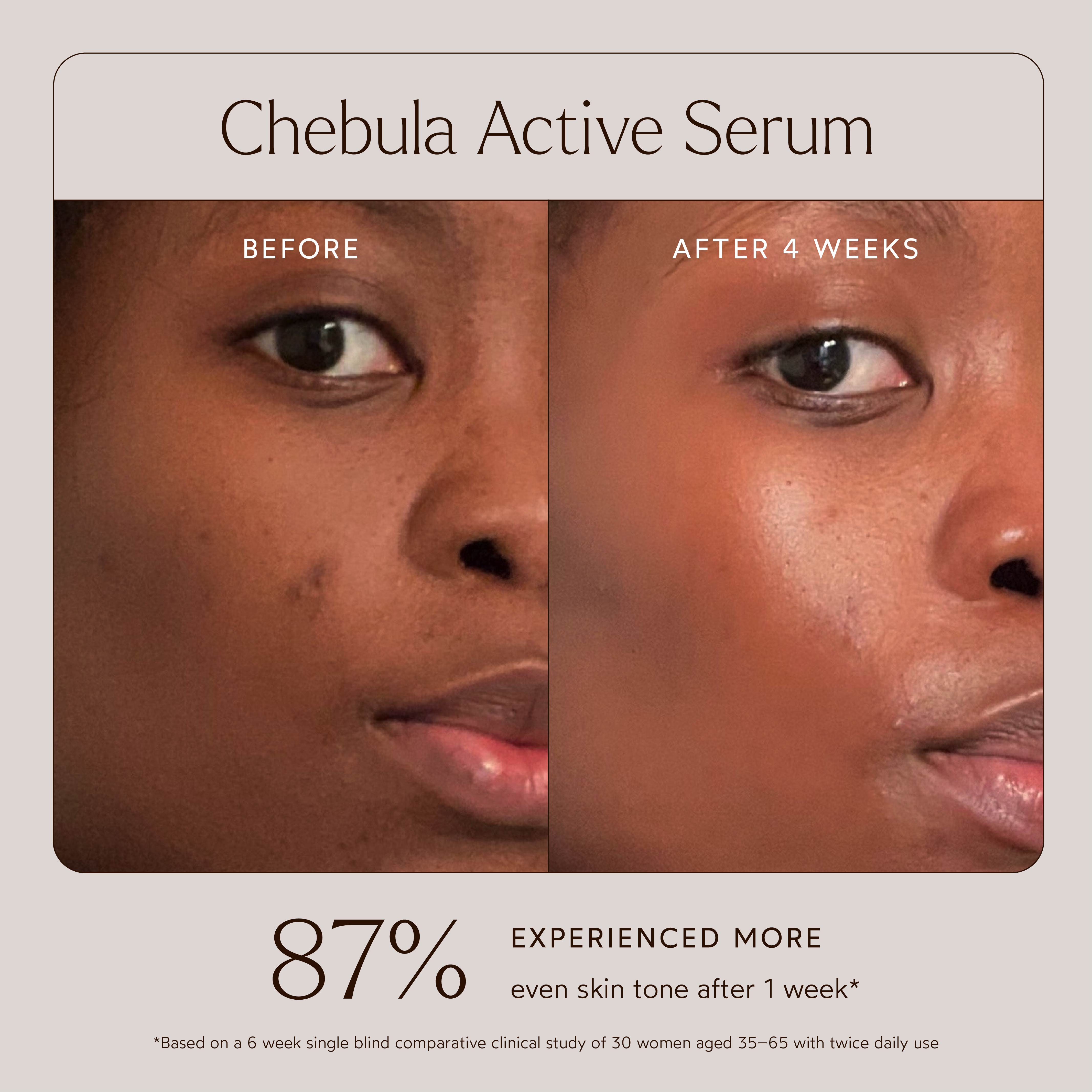 Chebula Active Anti-Aging Serum for Face - Organic Wrinkle Treatment & Skin Tightening Cream - Best for Night Routine, Dry Skin Care & Mature Skin Rejuvenation
