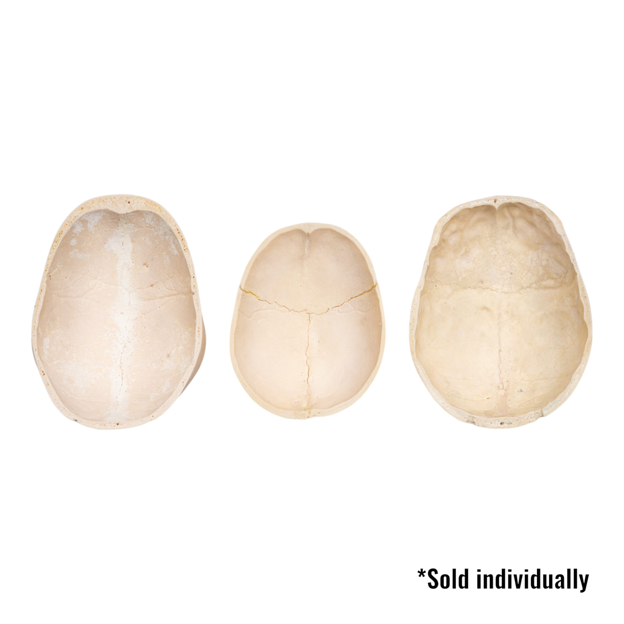 Real Human Calvaria Skull - Single Specimen for Medical Study, Anatomy Education & Research - Perfect for Medical Schools, Laboratories & Collectors