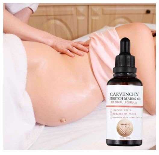 67 Stores Women's Moisturizing Body Skin Care Oil for Pregnancy & Postpartum - Stretch Mark Repair Oil, 30ml | Hydrating Treatment for Dry Skin, Anti-Itch & Scar Reduction - Perfect for Maternity Care & Post-Delivery Recovery