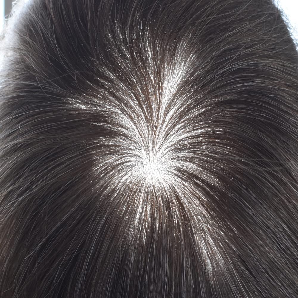 Premium 100% European Human Hair Toupee for Men - 0.12mm Thin Skin V-looped Hair Replacement System with Durable Poly Base (8