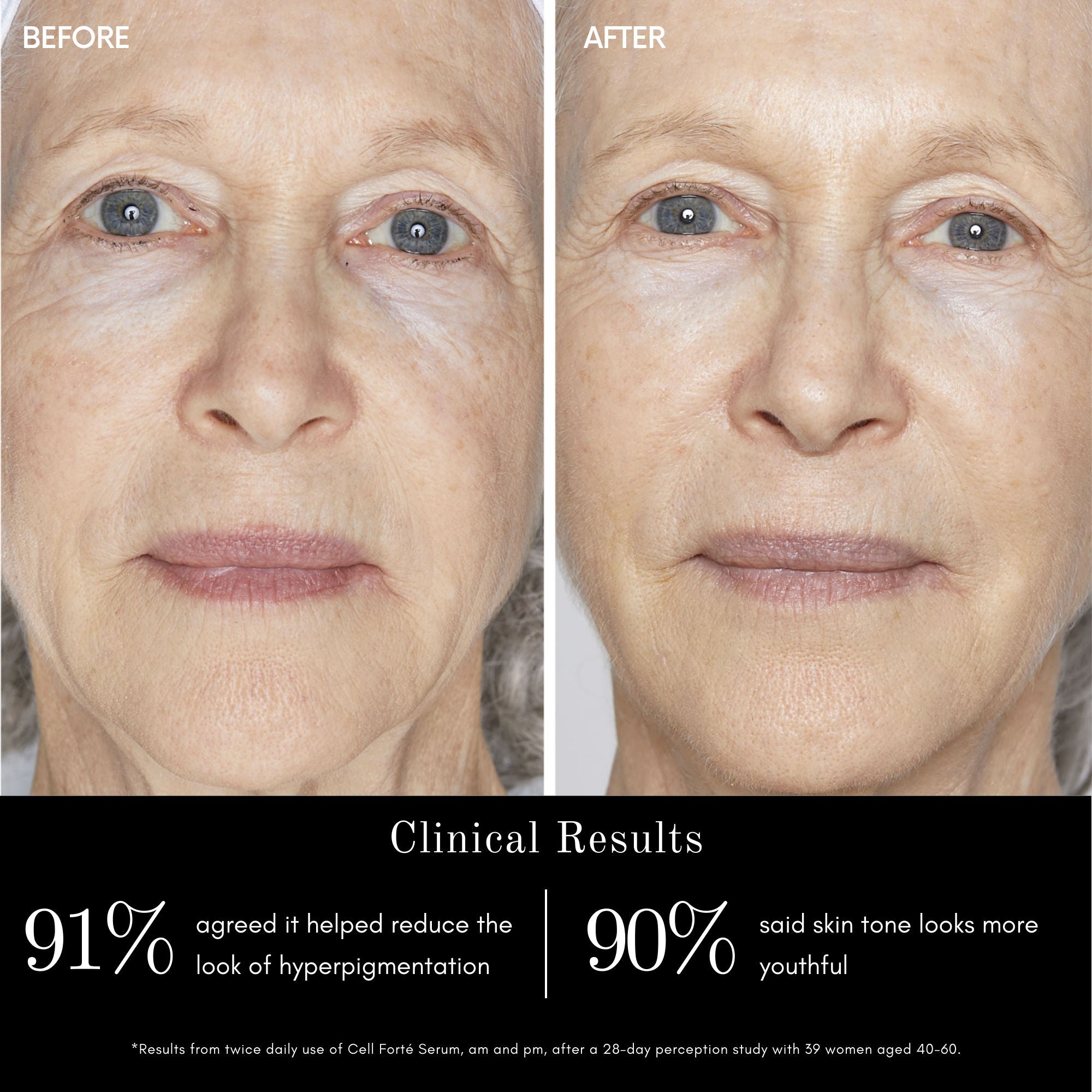 Cell Forté Serum with BIOMSC - Anti-Aging Face Serum for Wrinkles & Fine Lines | Hydrating & Firming Skincare for Daily Use