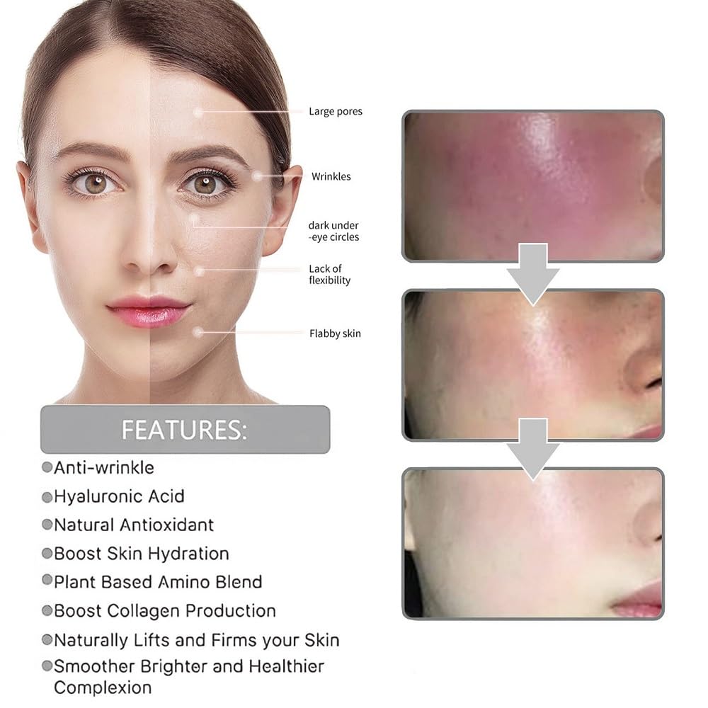 Melanclear Advanced Dark Spot Corrector & Anti-Aging Facial Serum - Collagen Boosting, Moisturizing & Brightening Daily Face Treatment (1PC) - Perfect for Morning/Night Skincare Routine & Hyperpigmentation Care