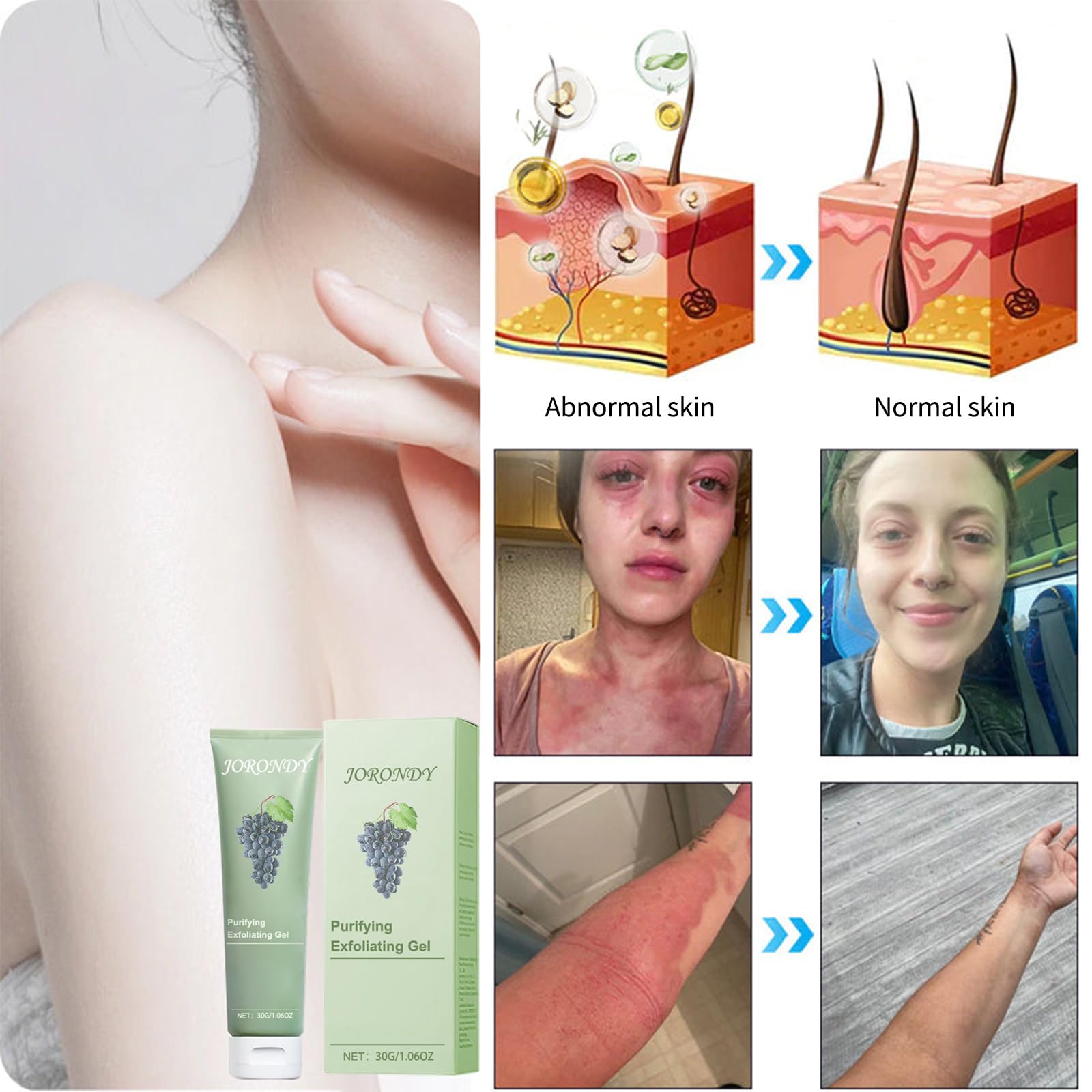 Lenaro JORONDY Purifying Exfoliating Gel - Gentle Face Scrub for Men & Women, Deep Cleansing Peel & Dead Skin Remover - Perfect for Daily Skincare Routine & Blackhead Treatment