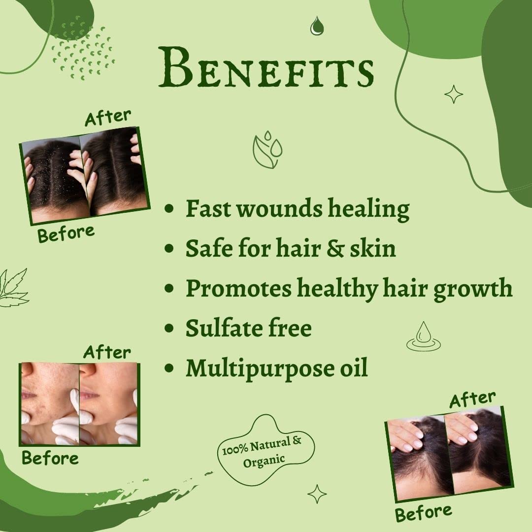 Pure Cold Pressed Neem Oil 100ml - Organic Multipurpose Oil for Hair Growth, Skin Care & Scalp Treatment | Natural Remedy for Acne, Dandruff & Dry Skin | Perfect for DIY Beauty & Aromatherapy