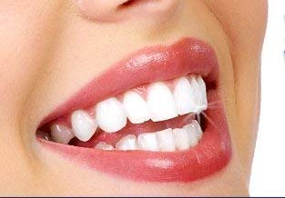 Miracle Brite Smile Teeth Whitening Kit with Food Grade Hydrogen Peroxide & Essential Oils - Whitens Teeth, Freshens Breath, Reduces Sensitivity | Perfect for Home Use, Travel, and Daily Oral Care