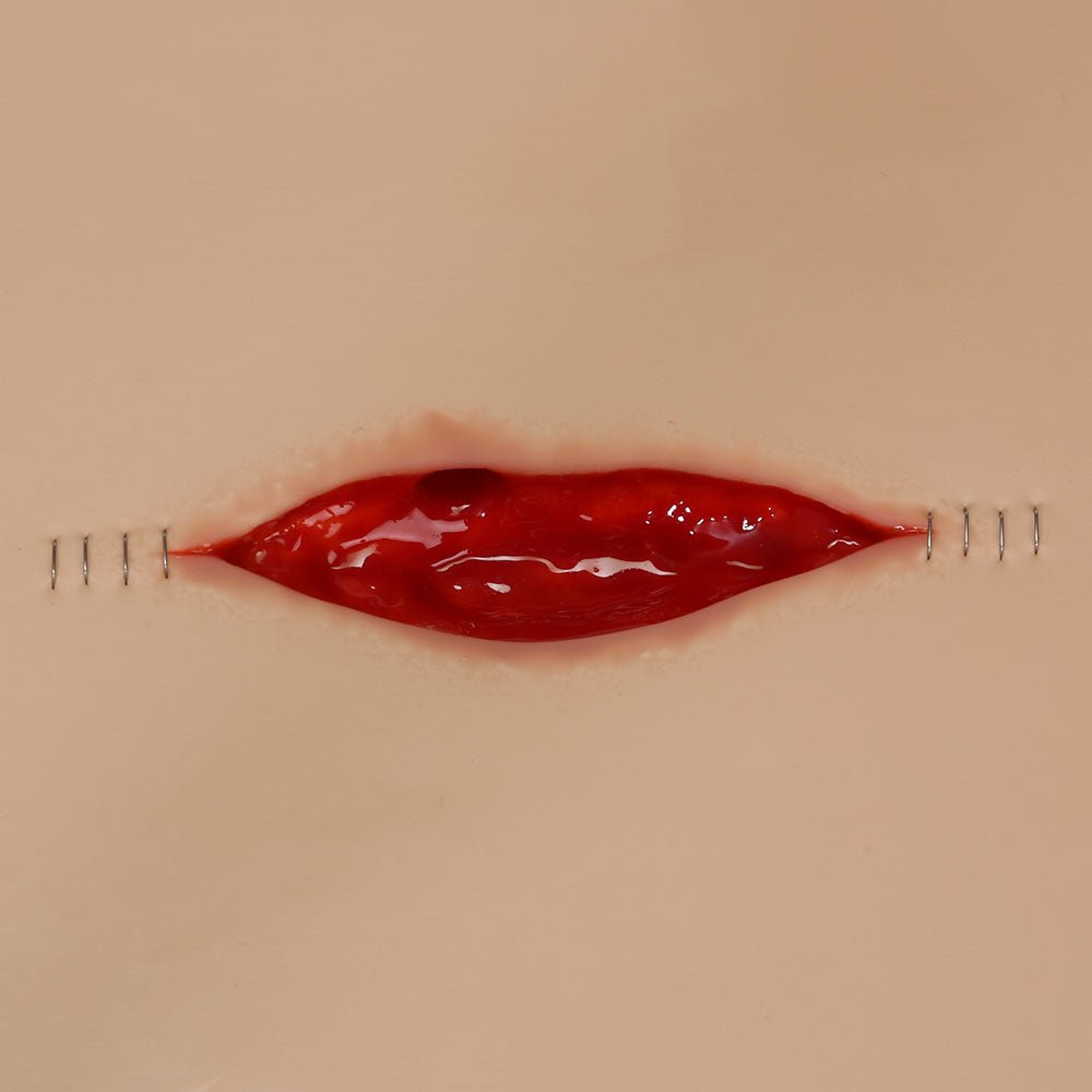 Dehisced Wound Dressing Board - Light Skin Tone | Medical Wound Care for Post-Surgical Recovery & Chronic Wound Management