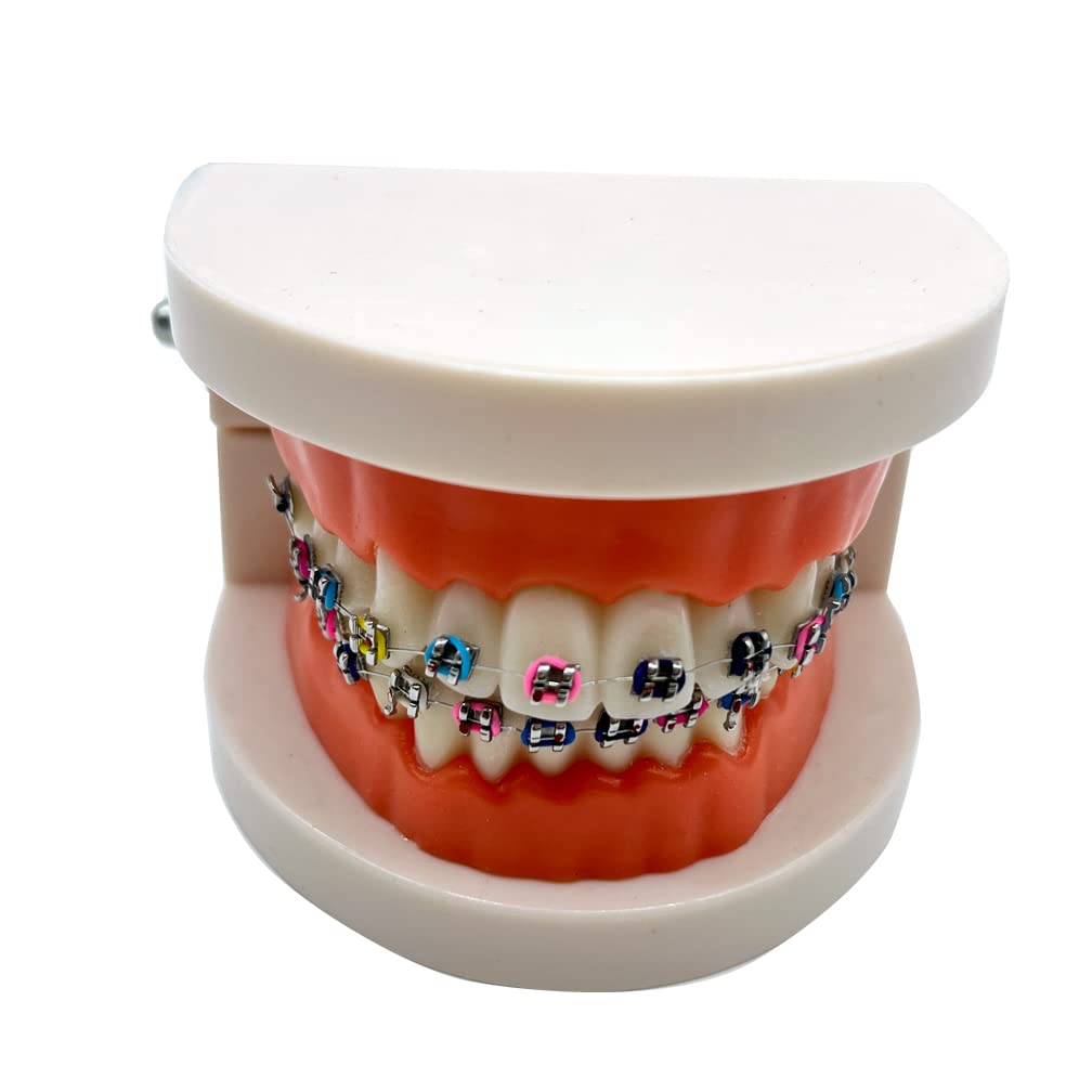 Orthodontic Dental Demonstration Model with Metal Brackets & Arch Wire - Standard Teeth Model for Braces Training & Education - Perfect for Dentists, Students & Orthodontic Practices