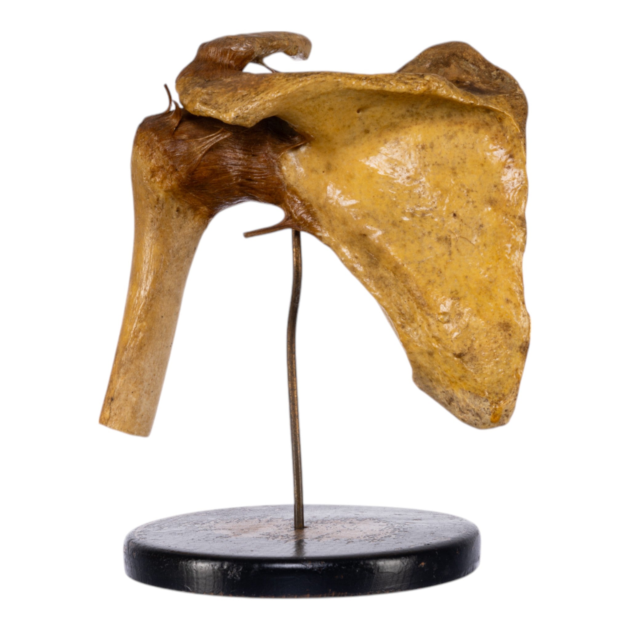 Real Human Left Shoulder Joint Anatomical Model on Stand - Medical Education, Orthopedic Study & Classroom Demonstration