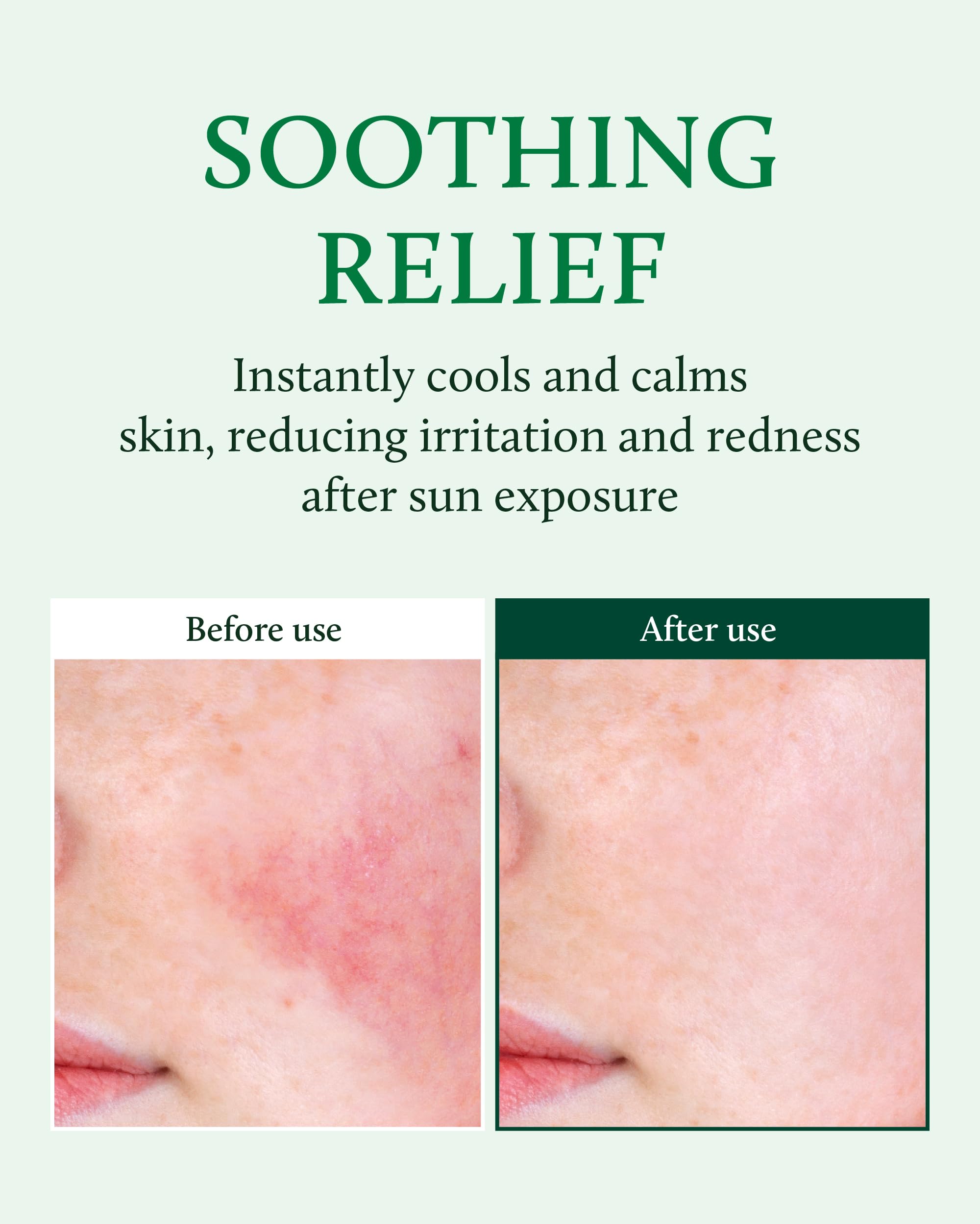 YADAH Cactus Soothing Gel - 95% Cactus Extract for Sunburn Relief & Skin Care - Vegan Korean Beauty for Face & Body