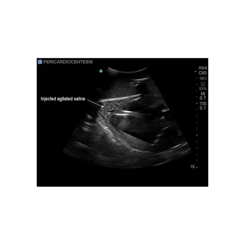 FAST Exam Ultrasound Training Model - Transthoracic & Transesophageal Echo Simulator for Cardiac Sonography Practice (Ideal for Medical Students, Ultrasound Tech Training & Clinical Skills Development)