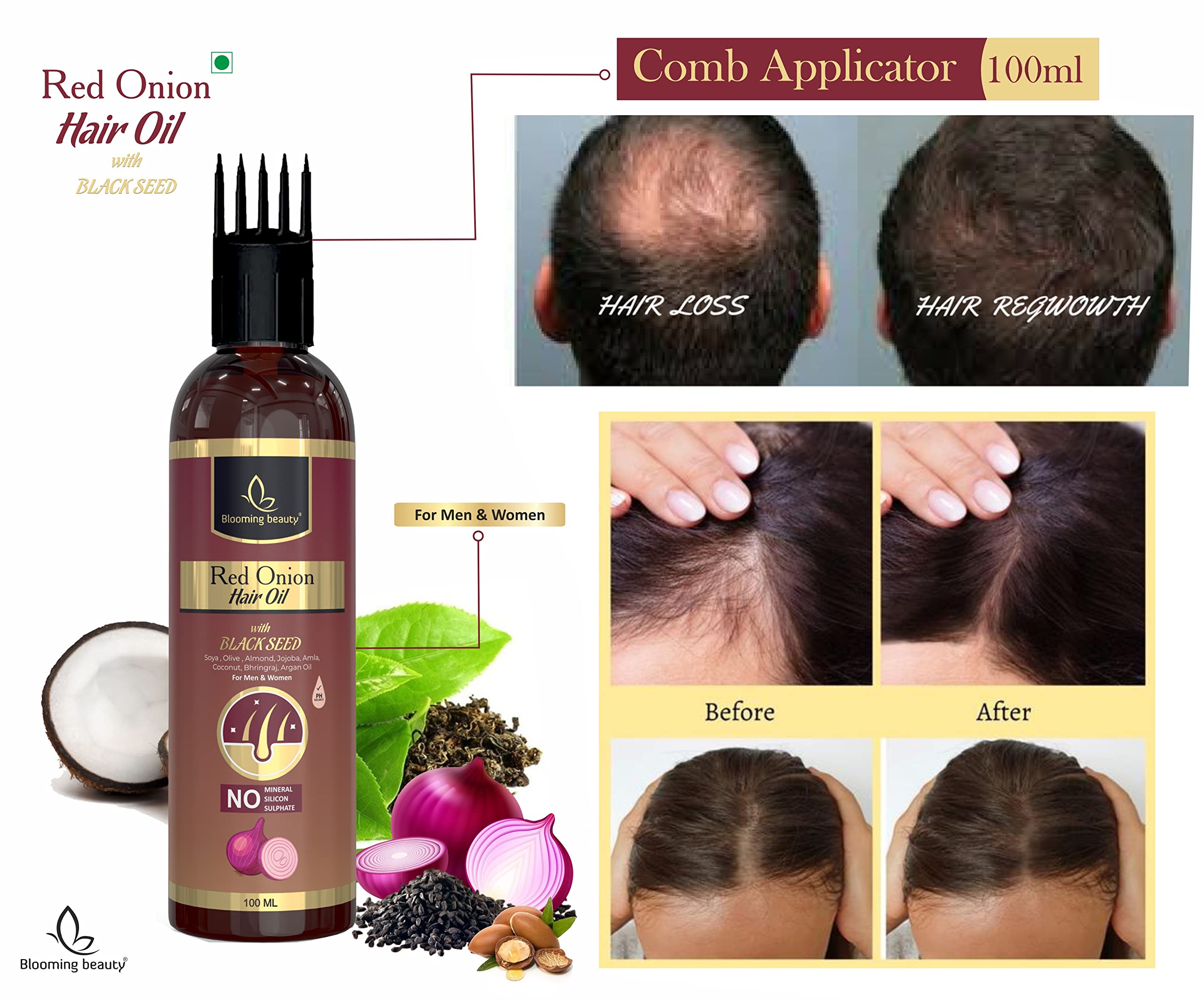 Blooming Beauty Red Onion Hair Growth Oil with Black Seed, Aloe Vera, Neem Leaf & Green Tea - 16 Natural Extracts for Hair Loss Control & Healthy Scalp (100ml with Oil Comb Cap) - Perfect for Daily Hair Care & Thinning Hair Treatment