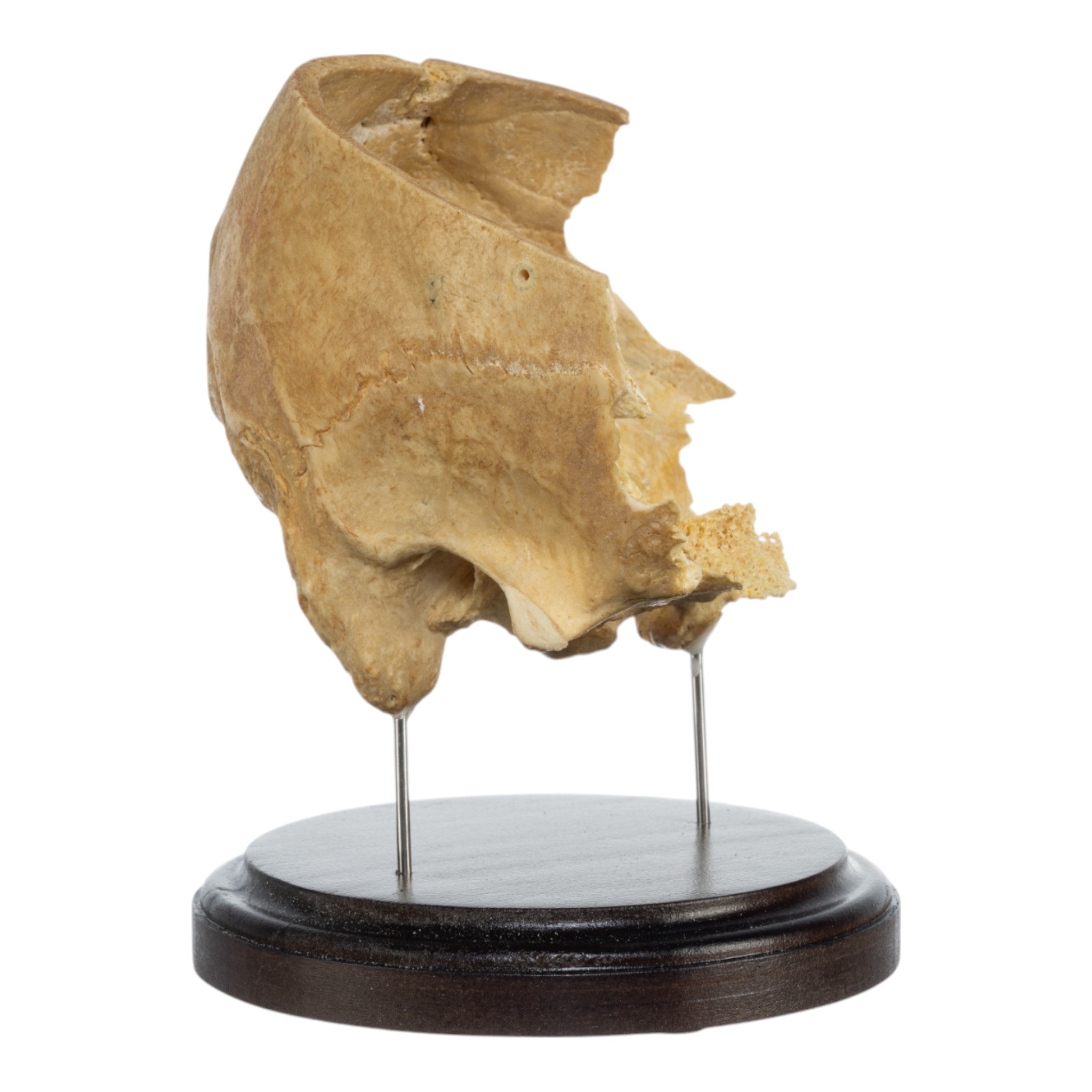 Real Human Partial Skull on Stand - Anatomical Model for Medical Study, Halloween Decor & Gothic Display - Perfect for Doctors, Students & Dark Aesthetic Collectors