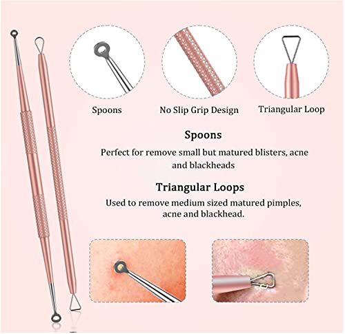 Professional Blackhead Remover Kit - Stainless Steel Acne & Blemish Extractor Tool for Face & Nose - Whitehead & Blackhead Popping Tools with Metal Case - Perfect for Home Skincare & Spa Treatments