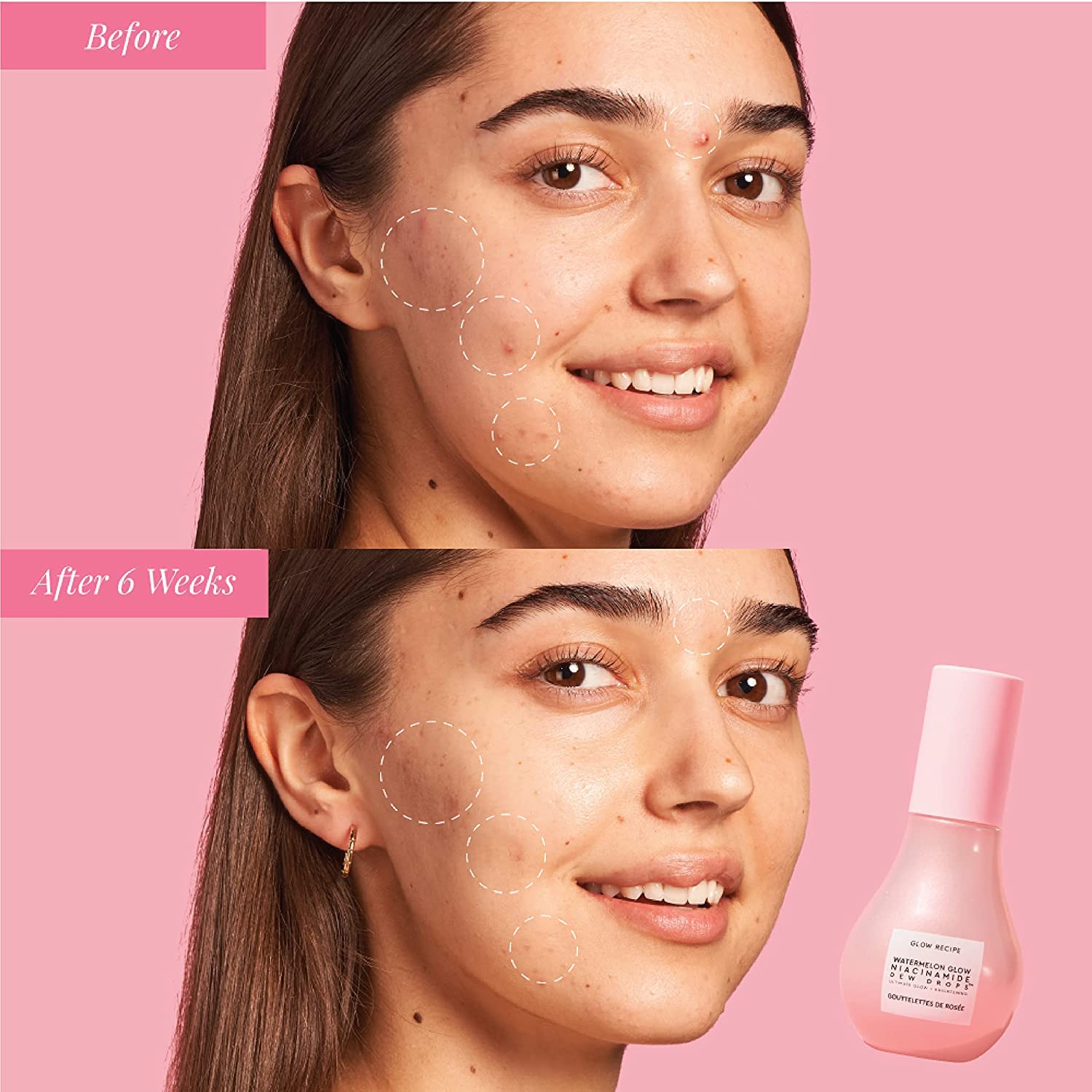Glow Recipe Niacinamide Serum - Hydrating Korean Skincare for Dewy Glass Skin - Perfect for Day & Night Routine