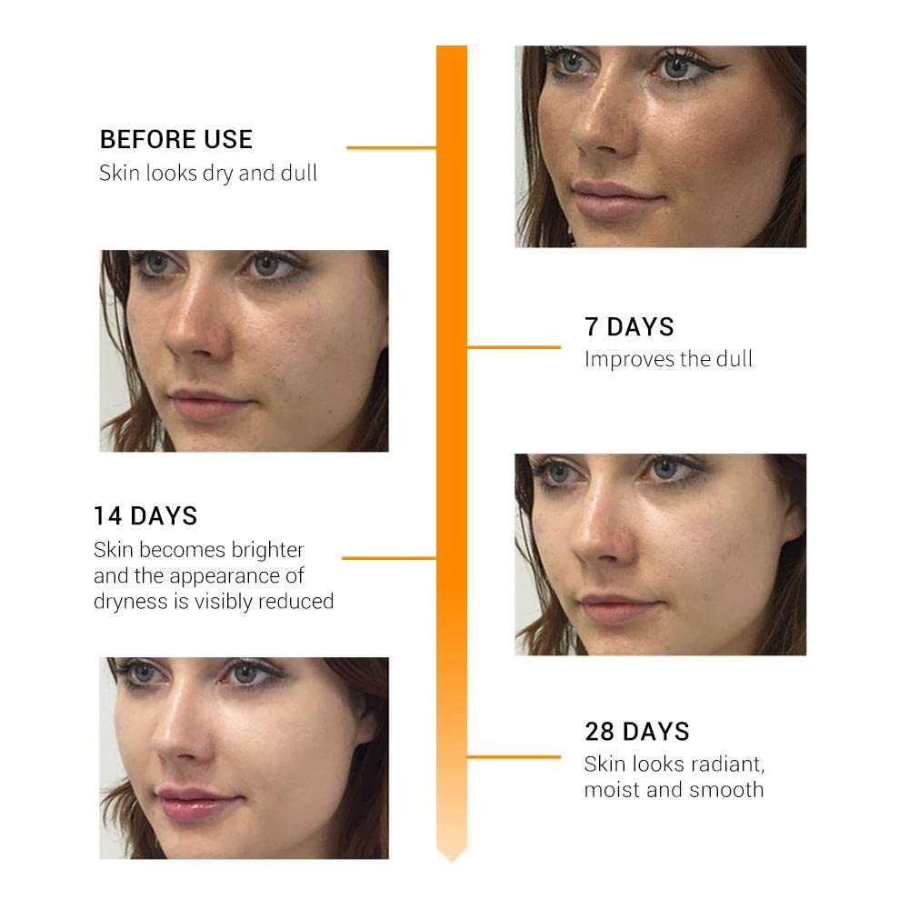 Forecast Skin Naturals Vitamin C Face Serum - Brightening & Spot Reduction Treatment for Glowing Skin, 30ml | Perfect for Morning Skincare Routine & Nighttime Anti-Aging Care