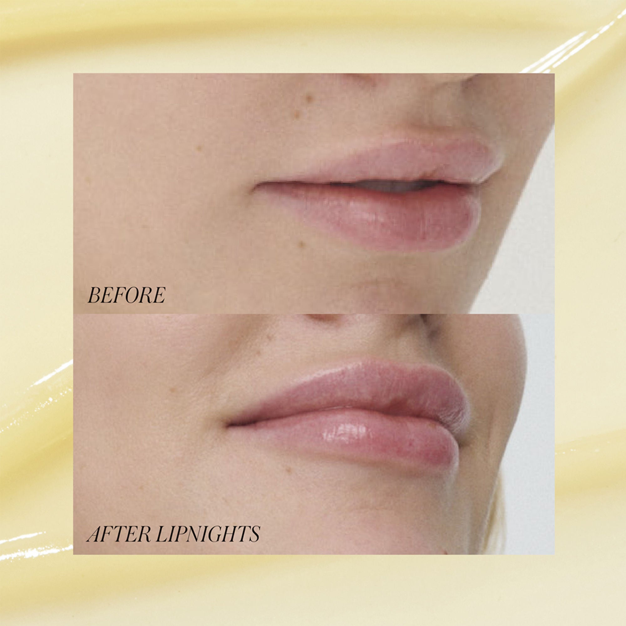 Lipnights Overnight Lip Mask - Hydrating & Plumping Treatment for Dry Lips | Perfect for Nighttime Care & Winter Lip Protection
