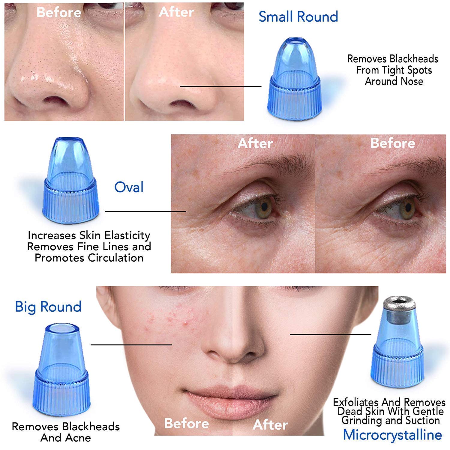 4-in-1 Blackhead & Whitehead Extractor Tool - Derma Suction Vacuum Pore Cleaner for Acne & Pimple Removal - Skin Care Device for Men & Women - Perfect for Home Facial & Deep Cleansing Routine