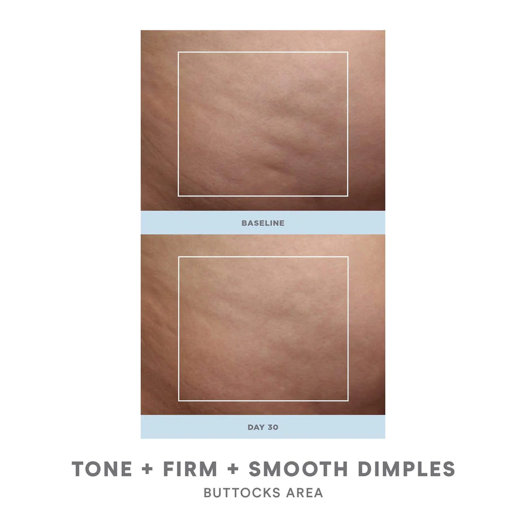 NuFACE NuBODY Body Toning Device - Professional Skin Tightening & Contouring for Arms, Legs & Abs | At-Home Body Sculpting & Anti-Aging Treatment