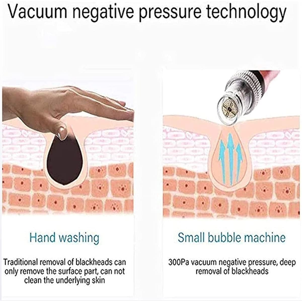 Professional Water Oxygen Beauty Machine - Facial Moisturizing Spray & Vacuum Suction for Blackhead Removal, Anti-Aging & Skin Rejuvenation | Hydrating & Whitening Treatment for Glowing Skin | Perfect for Home Spa & Salon Skin Care Routines
