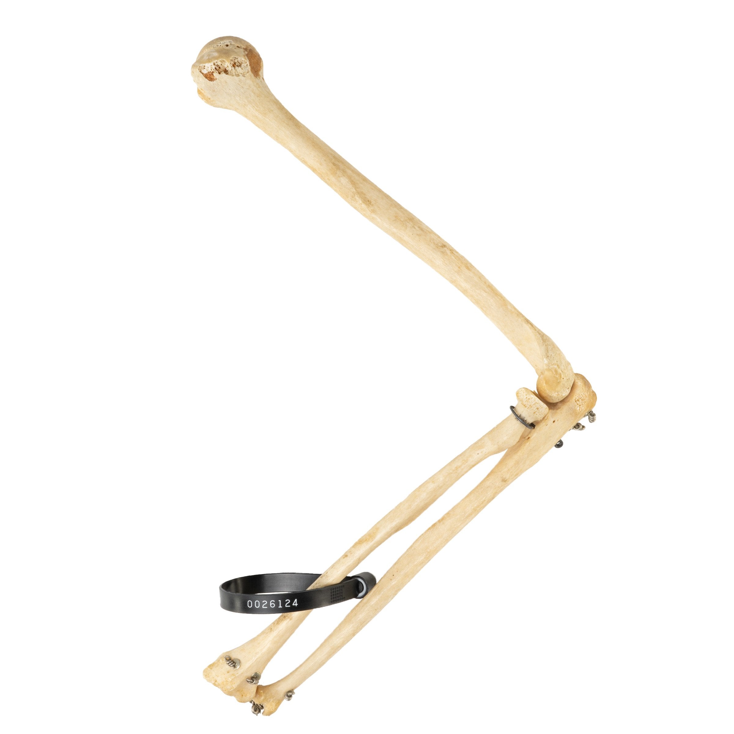 Authentic Human Humerus, Radius & Ulna Bones - Medical Education, Anatomy Study & Science Classroom Specimen