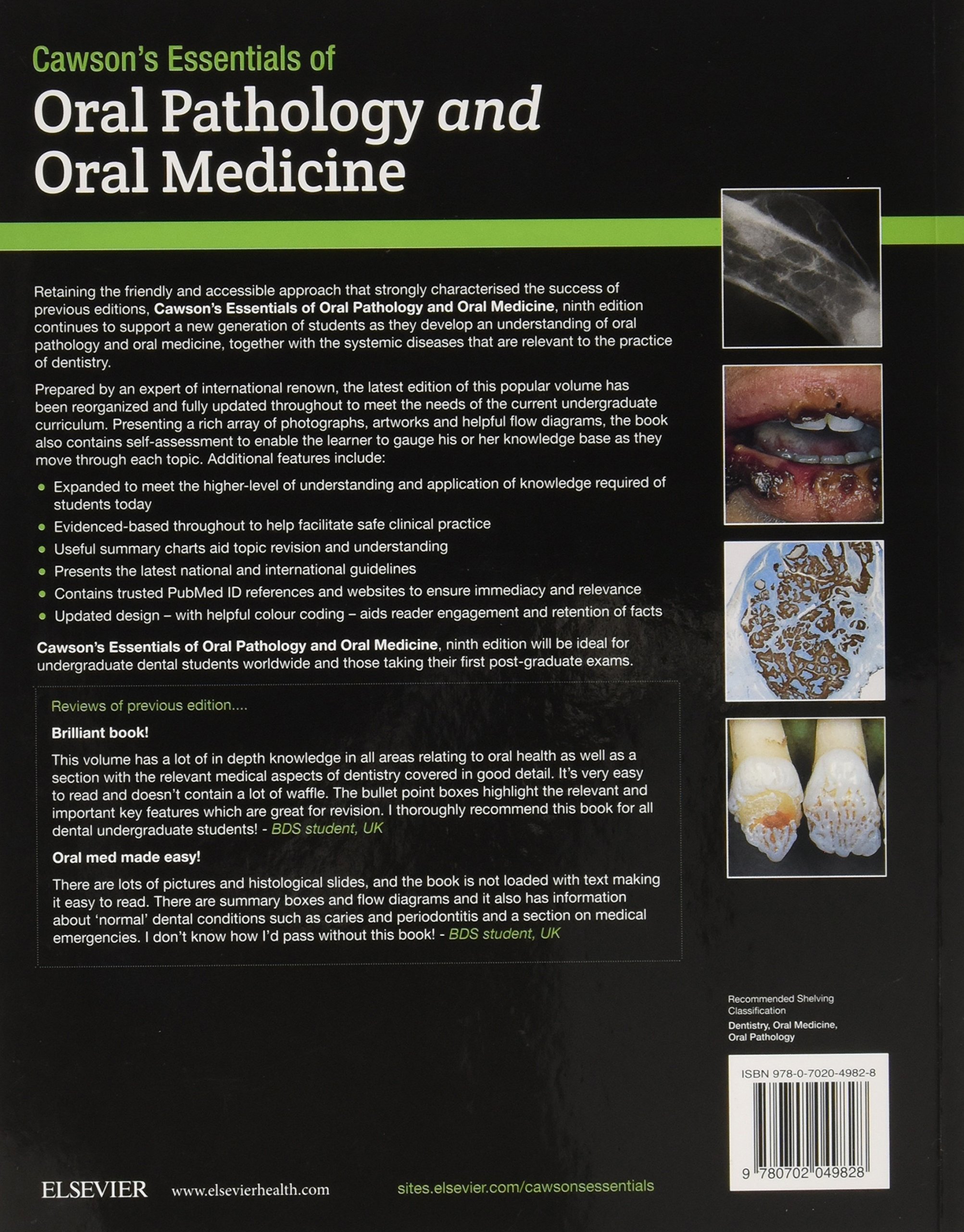 Cawson's Essentials of Oral Pathology and Oral Medicine - Comprehensive Dental Textbook for Students & Professionals - Perfect for Clinical Practice & Exam Preparation