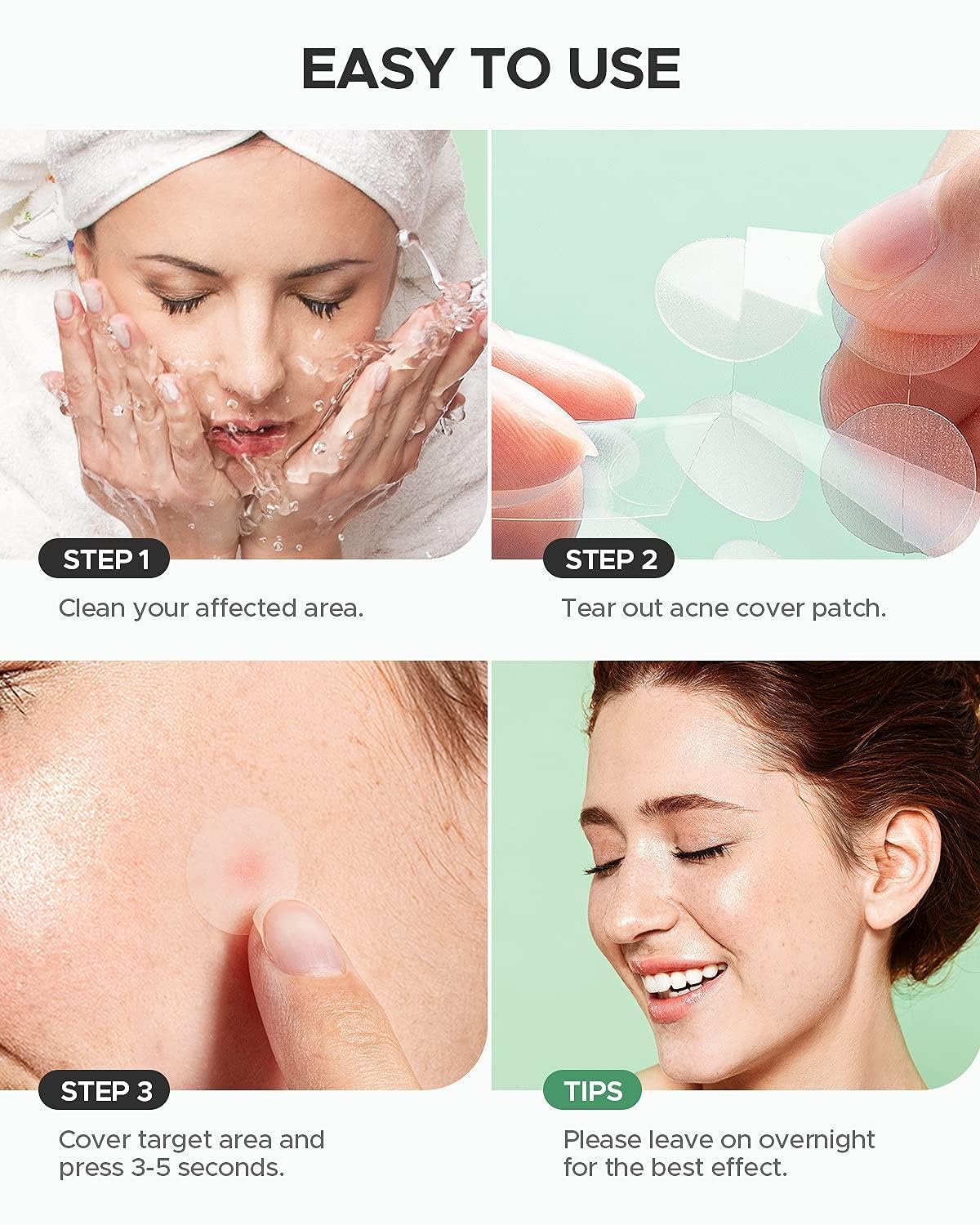 Hydrocolloid Acne Pimple Patch - 72 Dots | Fast Healing Spot Treatment for Zits, Blemishes & Breakouts | Vegan, Cruelty-Free Skincare | Face Care for Overnight Healing | Perfect for Teens & Adults with Acne-Prone Skin