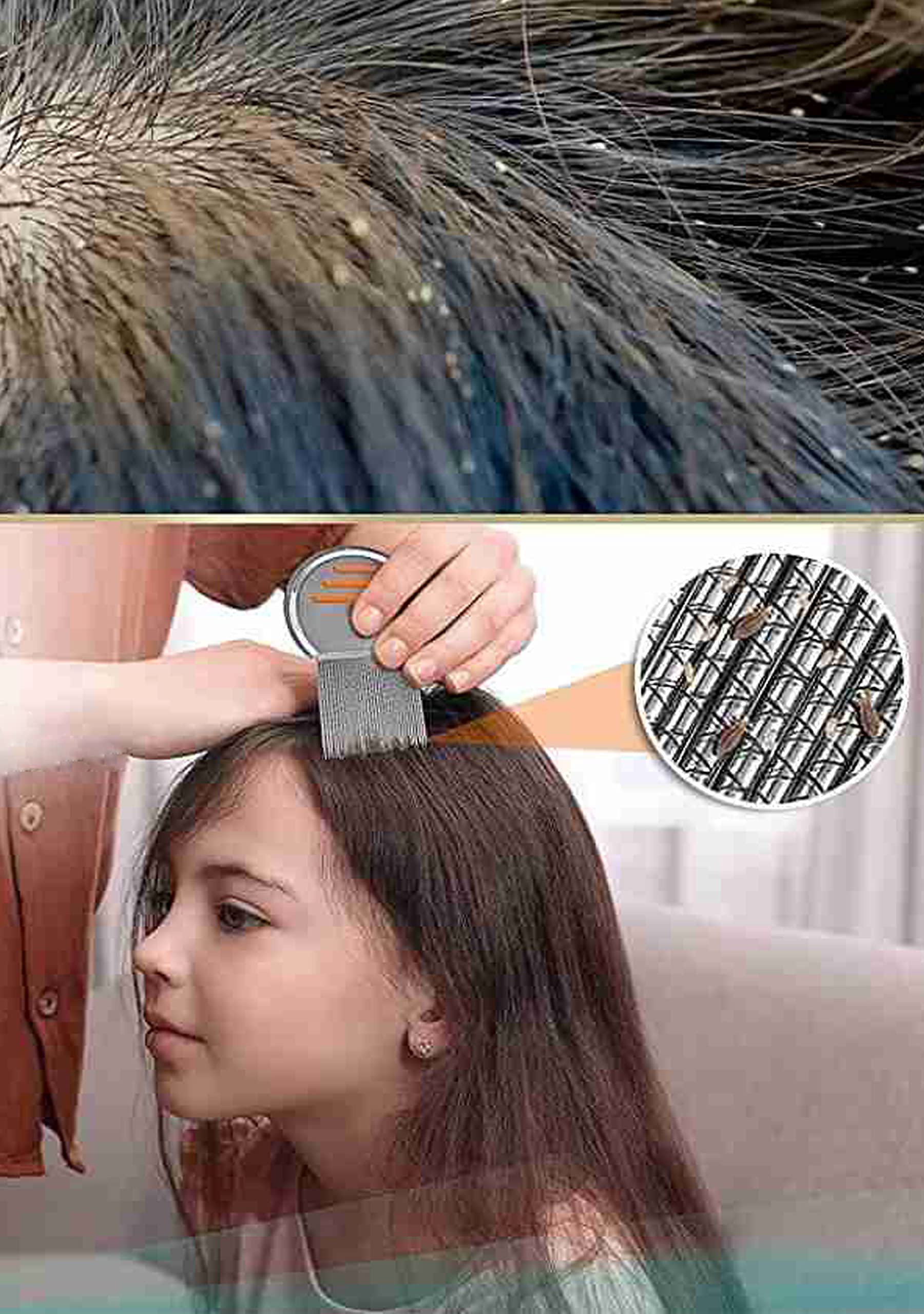 Jiyansh Traders Stainless Steel Lice Comb for Men, Women & Kids - 1PC Silver Unisex Hair Comb for Effective Lice Removal & Scalp Care - Perfect for Home, Travel & School Use