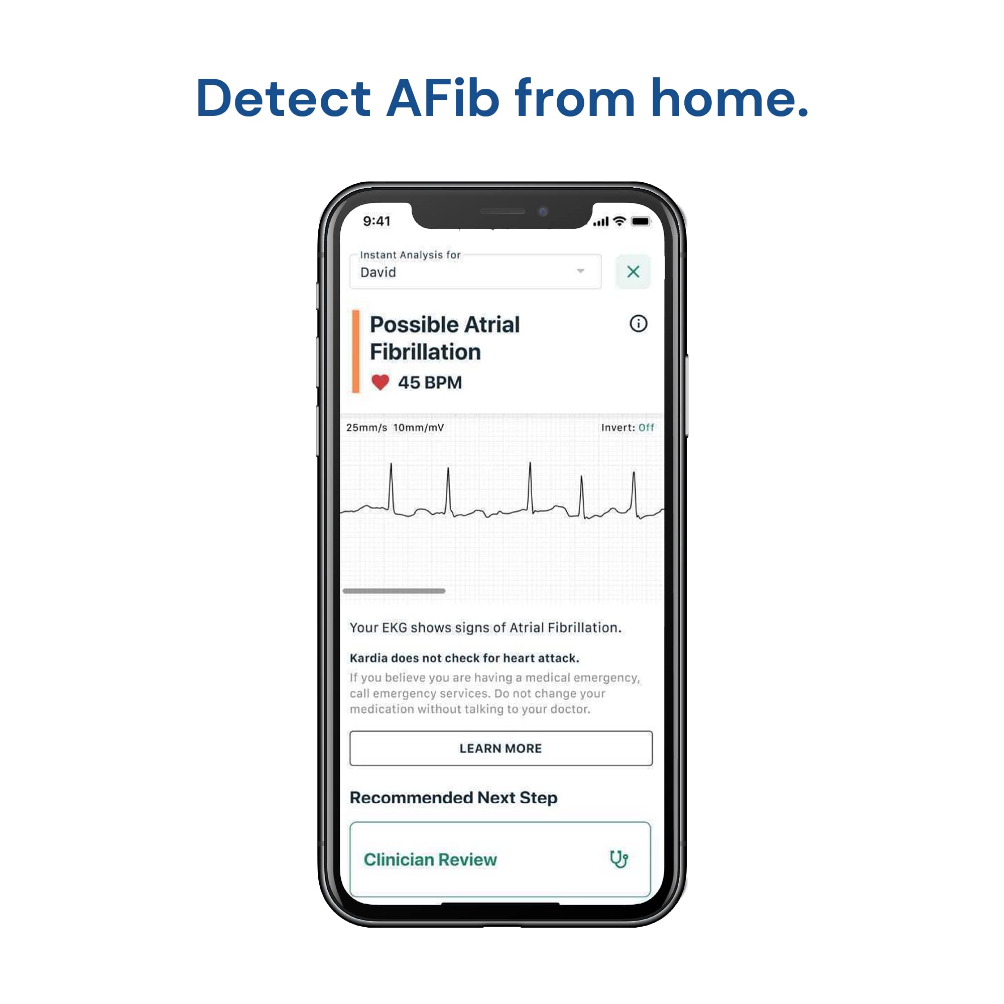 AliveCor KardiaMobile Wireless ECG Monitor - Portable EKG Device for Atrial Fibrillation Detection | Home Heart Health Monitoring | Perfect for Travel, Gym & Remote Cardiac Care