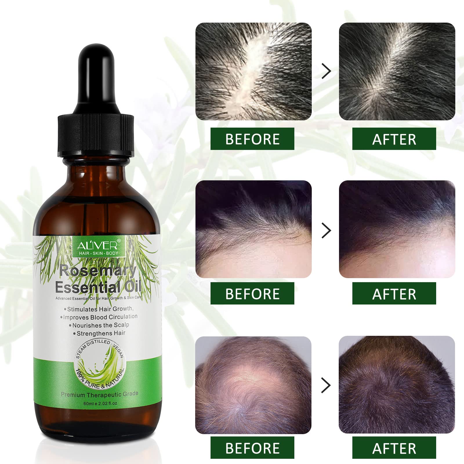 Organic Rosemary Essential Oil for Hair Growth & Scalp Care - 100% Pure Natural Hair Oil (60ml) - Aromatherapy Diffuser & Massage Oil - Promotes Thicker Hair & Healthy Scalp - Perfect for Daily Hair Care Routine & Relaxation Therapy