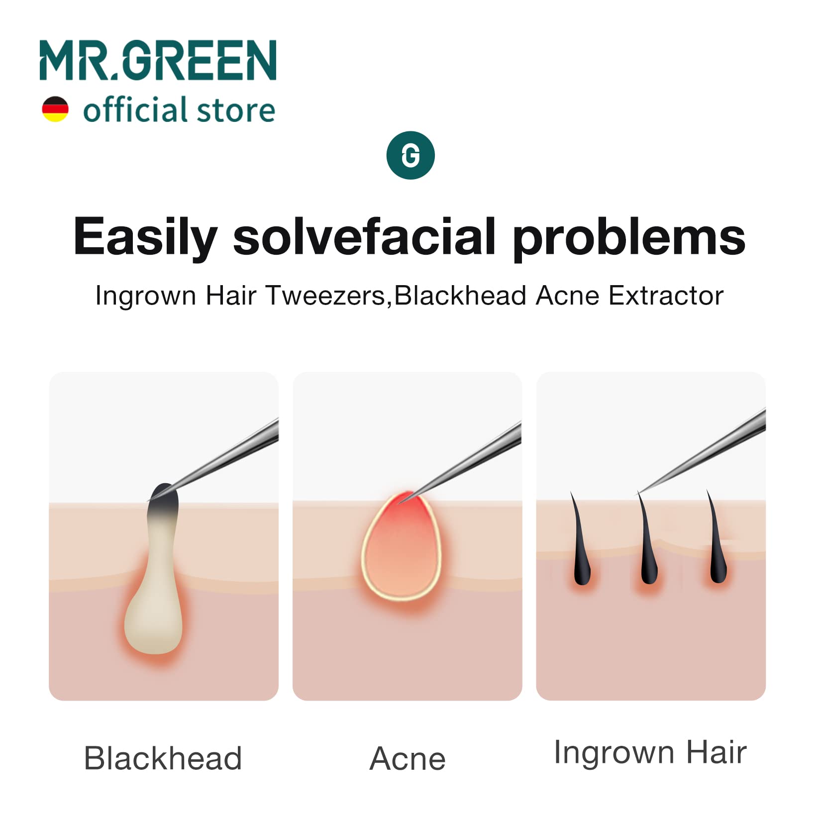 MR.GREEN Ingrown Hair Tweezers - Precision Pointed Tip Stainless Steel Tweezers for Eyebrow Grooming, Splinter Removal, Blackhead & Acne Extraction - Perfect for Travel, Home & Professional Salon Use