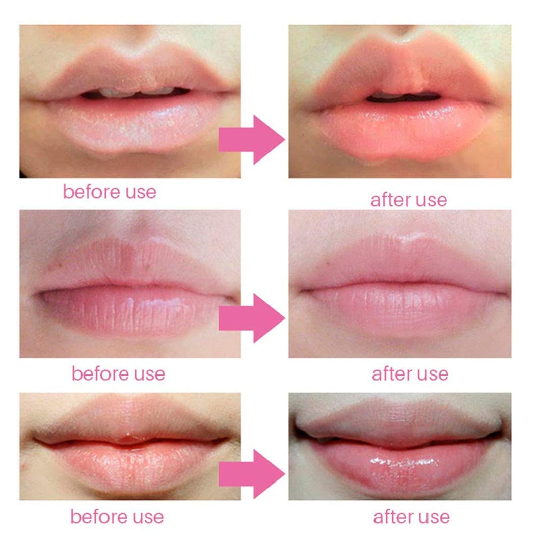 30 PCS Pink Crystal Collagen Hydrogel Lip Mask Set - Moisturizing & Hydrating Lip Plumper Gel Pads for Dry Lips | Peach Scented Lip Care Treatment for Soft, Attractive Lips | Perfect for Night Care, Makeup Prep & Winter Lip Protection