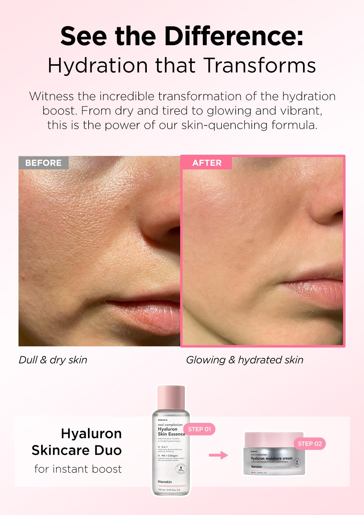 Hanskin Real Complexion Hyaluronic Skin Essence - Hydrating Toner with Hyaluronic Acid & Collagen for Dry, Dull, Sensitive Skin | Korean Skincare for Face | Paraben-Free, Moisturizing & Purifying | 5.07 fl oz | Perfect for Daily Hydration & Skin Barrier Repair