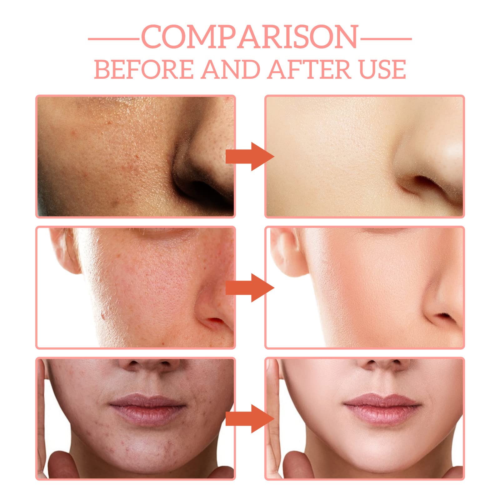 5 in 1 Vitamin C Facial Serum - 30% Vitamin C, Hyaluronic Acid & Niacinamide for Anti-Aging, Wrinkle Reduction & Hydration - Collagen Boosting with Vitamin E - 1.05 Fl.oz - Perfect for Daily Skincare Routine & Nighttime Rejuvenation