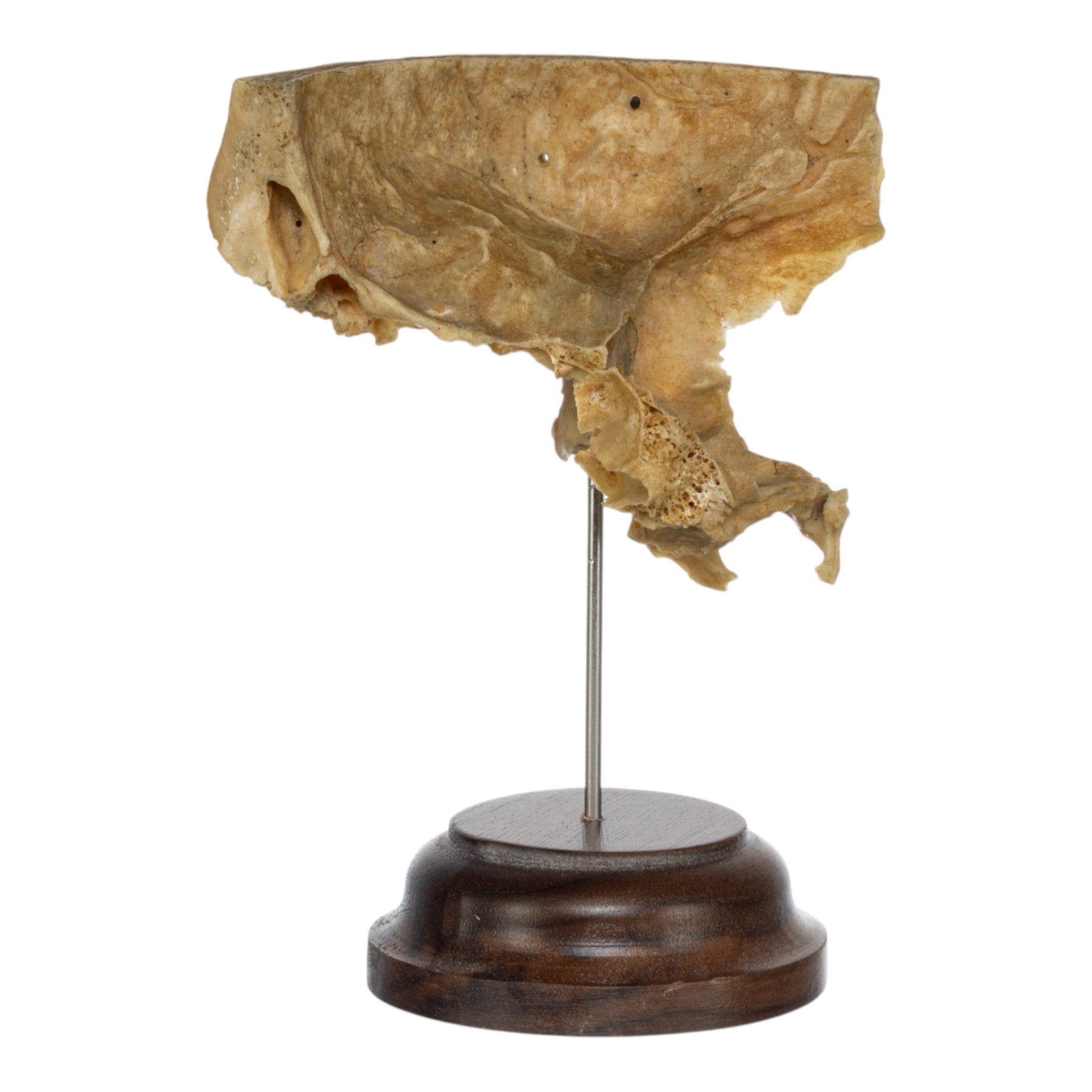 Real Human Partial Skull Replica with Display Stand - Anatomical Model for Medical Education, Halloween Decor, and Science Classroom Display