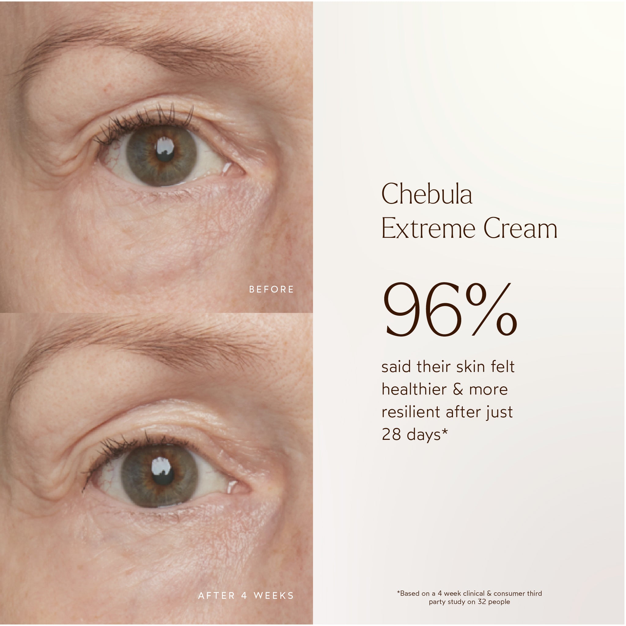 Renew Chebula Extreme Cream – Anti-Aging Face Moisturizer for Wrinkles & Fine Lines | Hydrating & Firming Skincare for Daily Use