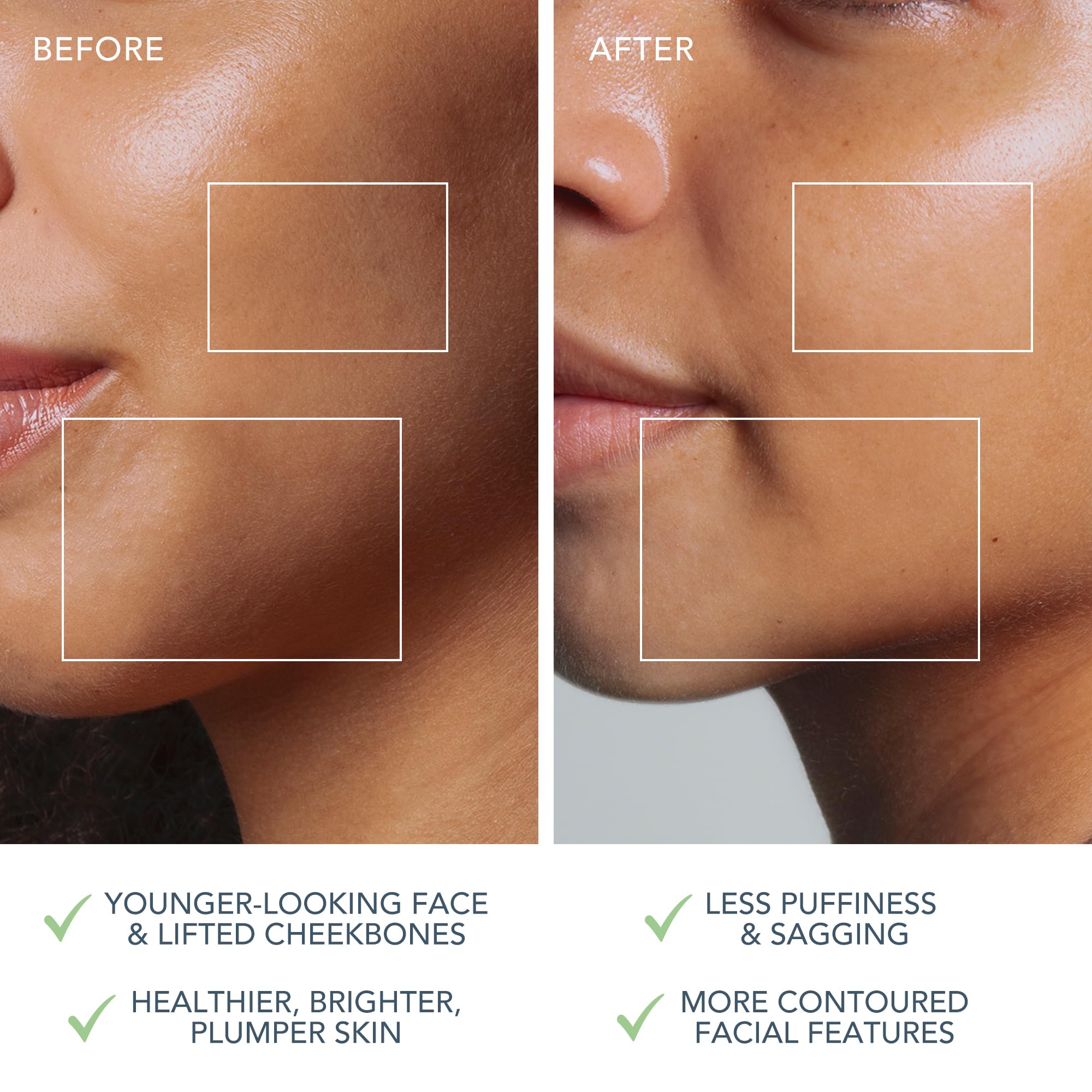 FOREO Bear 2 Go Microcurrent Facial Toning Device - Anti-Aging & Lifting Treatment for Wrinkles | Portable At-Home Skincare Tool for Face & Neck | Perfect for Travel, Gym & Daily Beauty Routine