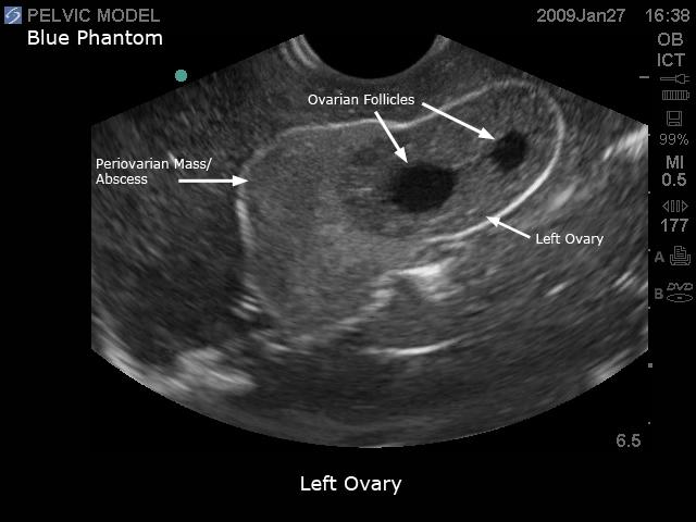 General Pathology Transvaginal Ultrasound Training Model - High-Quality Medical Simulation for OB/GYN Education & Clinical Practice - Perfect for Medical Schools, Hospitals & Diagnostic Labs