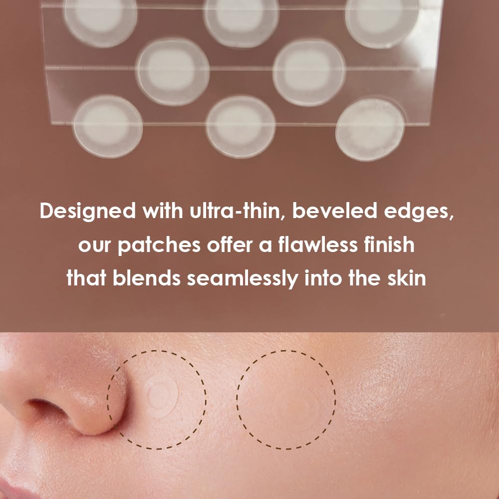 Magic Patch - Hydrocolloid Acne Pimple Patches for Zits & Blemishes | 38 Count Spot Stickers for Face & Skin Care | Korean Beauty (K-Beauty) | Perfect for Overnight Treatment & Daily Acne Relief