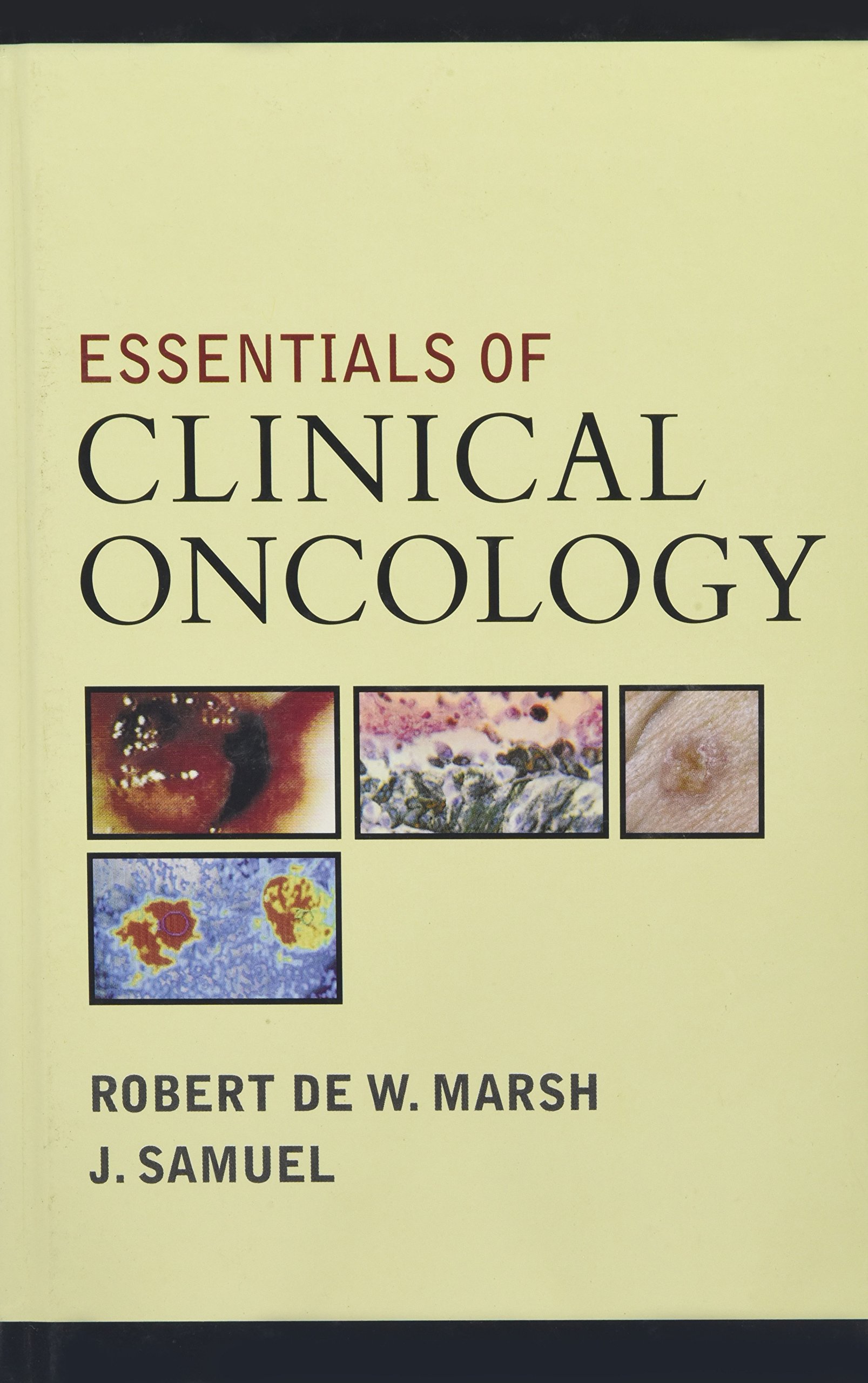 Essentials of Clinical Oncology - Comprehensive Guide for Medical Professionals | Cancer Treatment Reference Book for Doctors, Nurses & Students