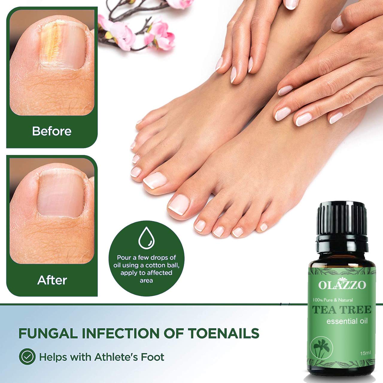 Pure Tea Tree Essential Oil for Skin, Hair & Nails - 100% Natural Steam Distilled Treatment for Acne, Dandruff & Healthy Toenails | 30ml Organic Oil for Face Care, Hair Growth & Foot Health