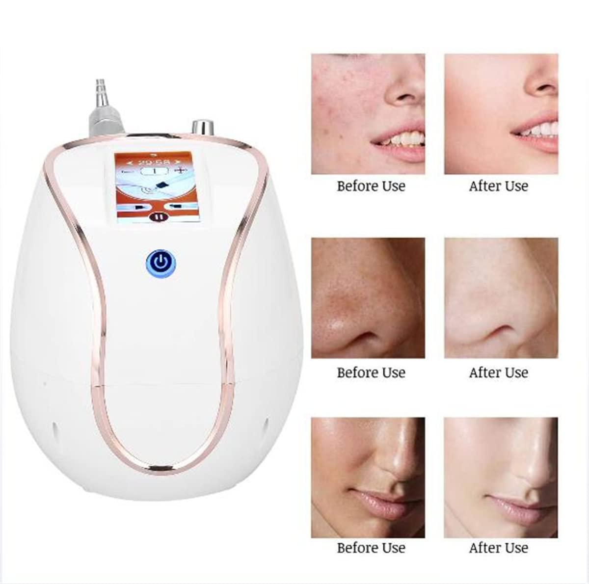 Professional RF Skin Tightening & Lifting Machine with Nano Mist Sprayer - Anti-Aging Facial Steamer for Deep Moisturizing & Pore Cleaning | At-Home Spa & Salon Quality Skin Care Device
