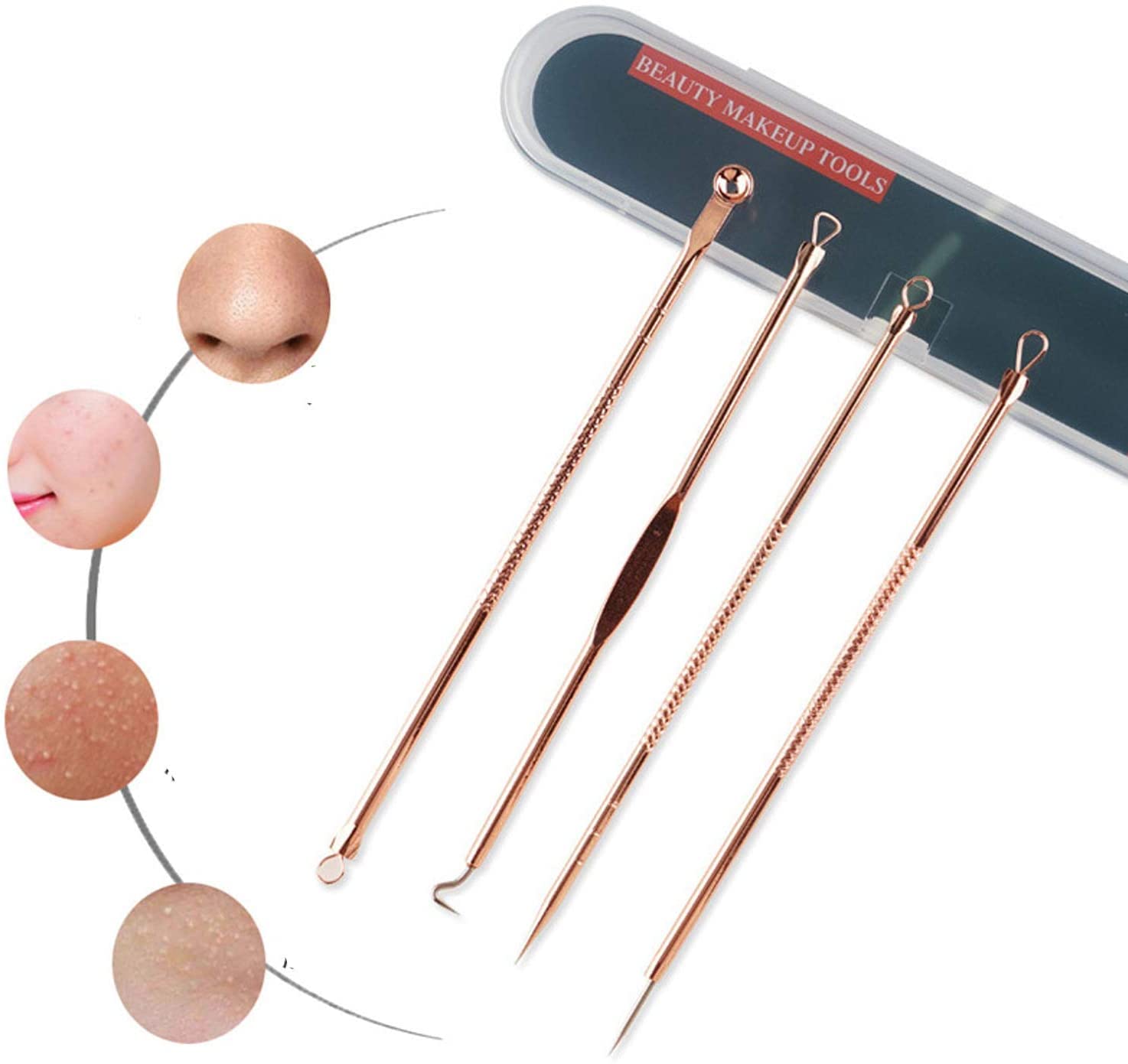 Professional Blackhead Remover Kit - 4-Piece Acne Treatment Tools for Whitehead & Comedone Extraction | Safe Blemish & Zit Removal for Face & Nose | Includes Travel Case (Rose Gold) | Perfect for Home Skincare & Travel Beauty Routine