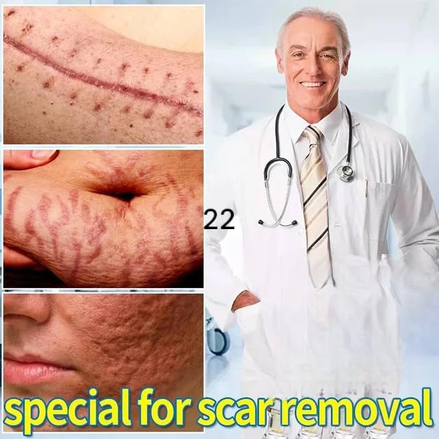 Best Stretch Mark Removal Cream for Men & Women - Pregnancy Safe, Scar & Wrinkle Treatment | Postpartum Care & Skin Repair