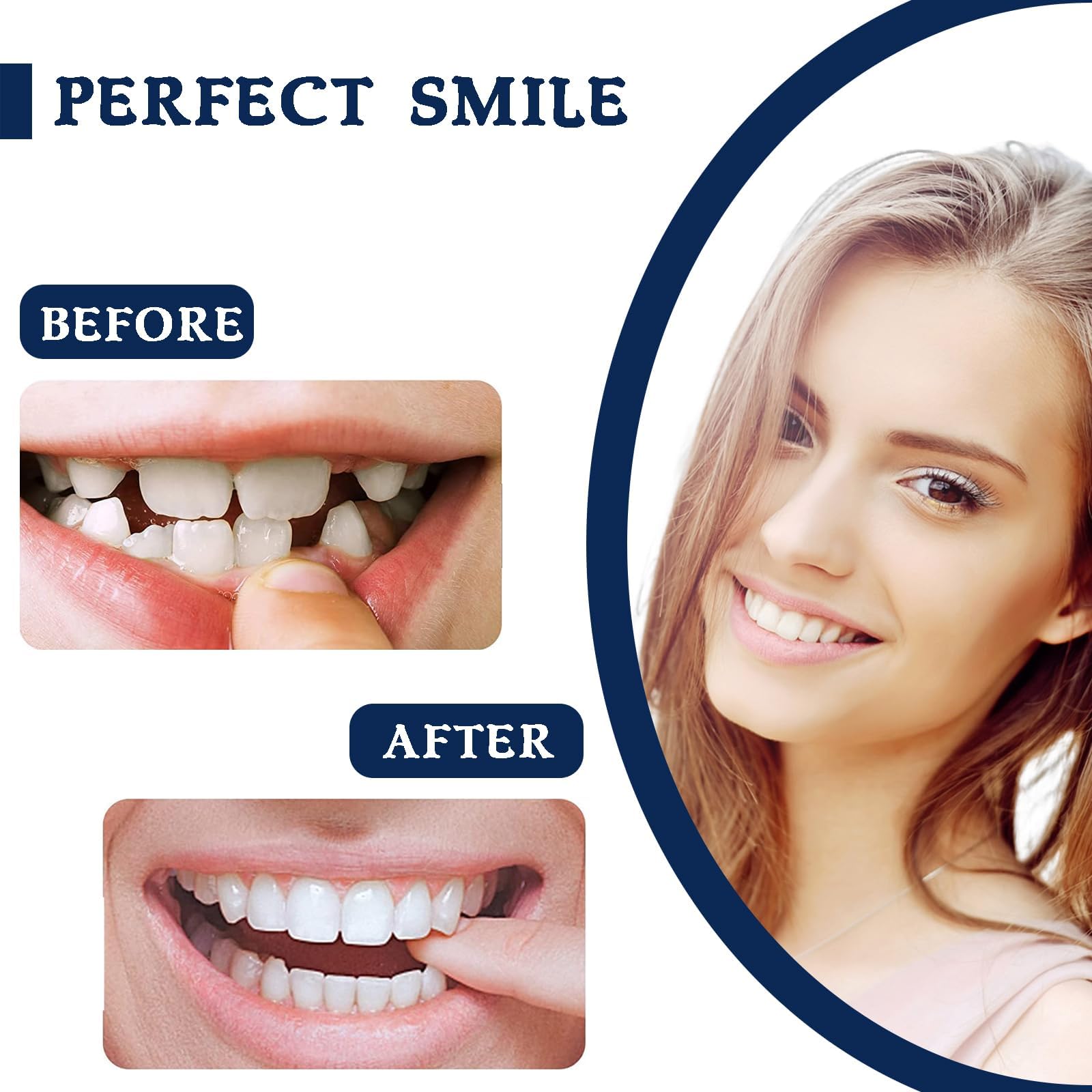 Natural & Comfortable Temporary Fake Teeth for Women & Men - Cosmetic Denture Veneers for Upper & Lower Jaw to Regain Confident Smile | Perfect for Parties, Weddings, and Daily Wear