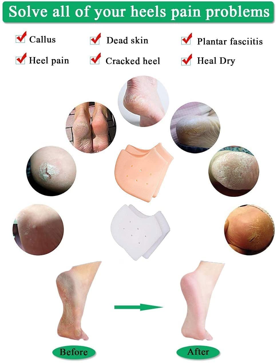 IGADG - Silicone Gel Heel Pads for Pain Relief, Heel Swelling & Cracked Heels - Foot Care & Ankle Support Protectors for Men & Women - Perfect for Running, Walking, Work & Daily Comfort