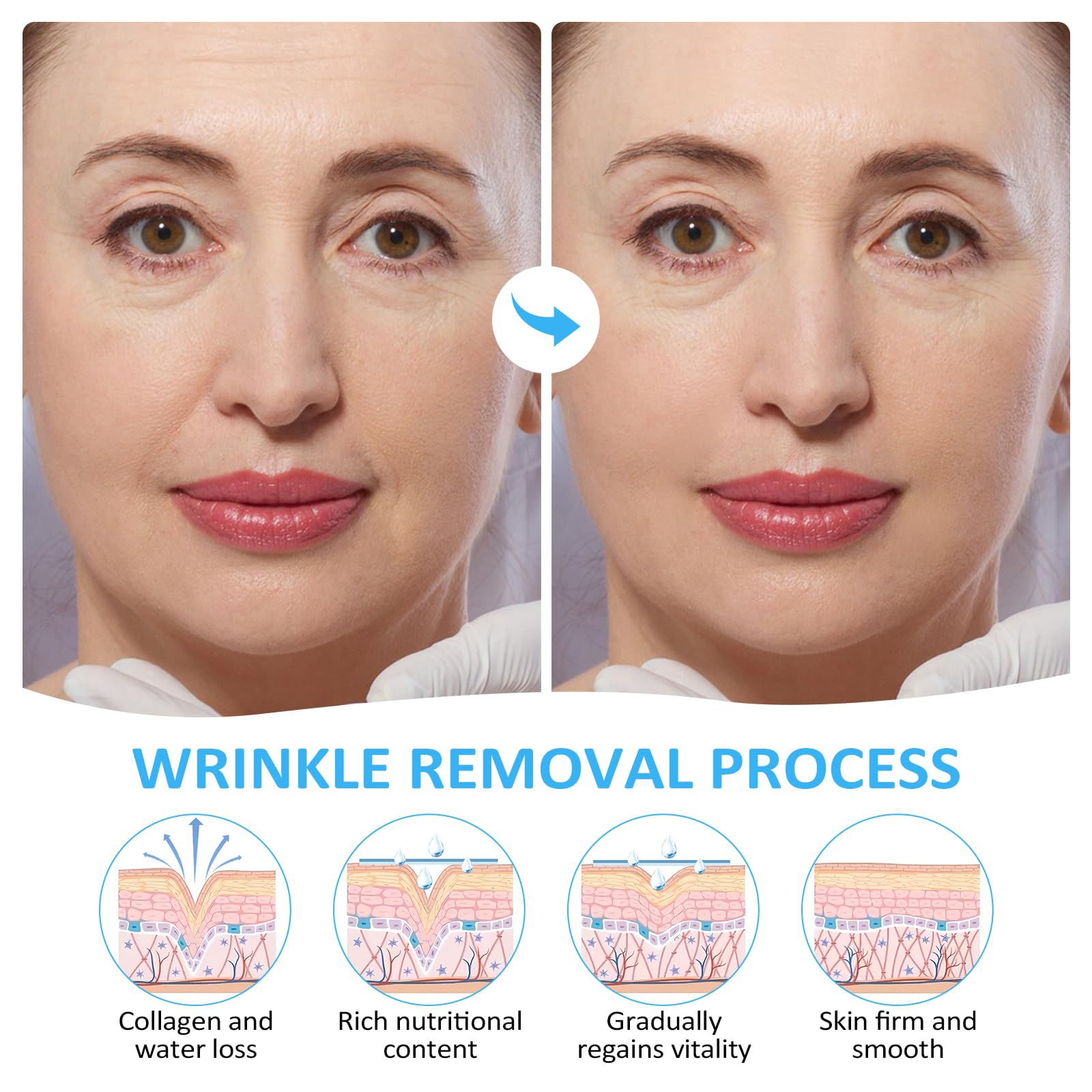 16Pcs Anti-Wrinkle Forehead Patches & 32Pcs Smile Line Patches - Collagen & Vitamin E Infused for Wrinkle Reduction - Perfect for Overnight Treatment & Daily Skincare Routine